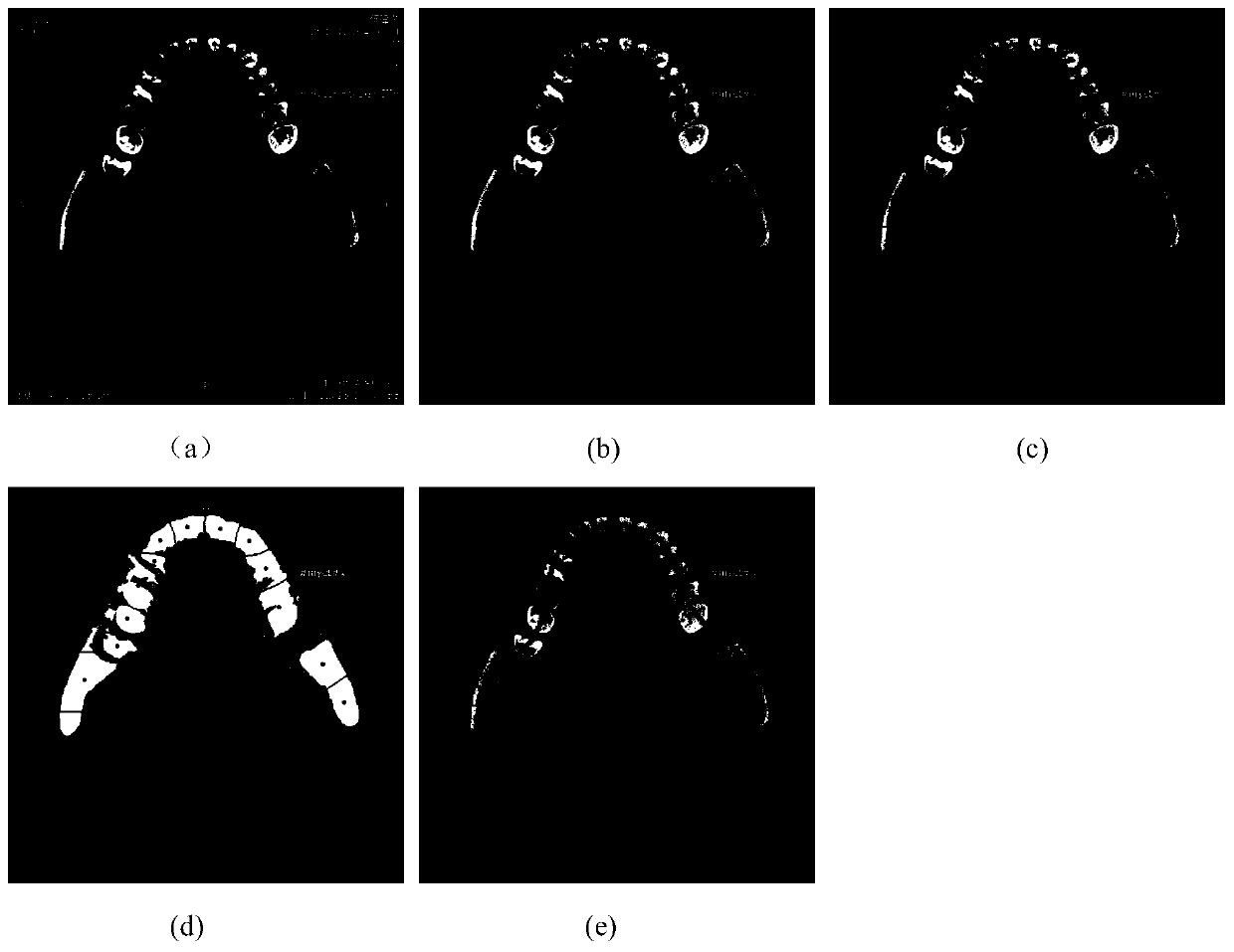 Dental arch line drawing method based on superpixel clustering