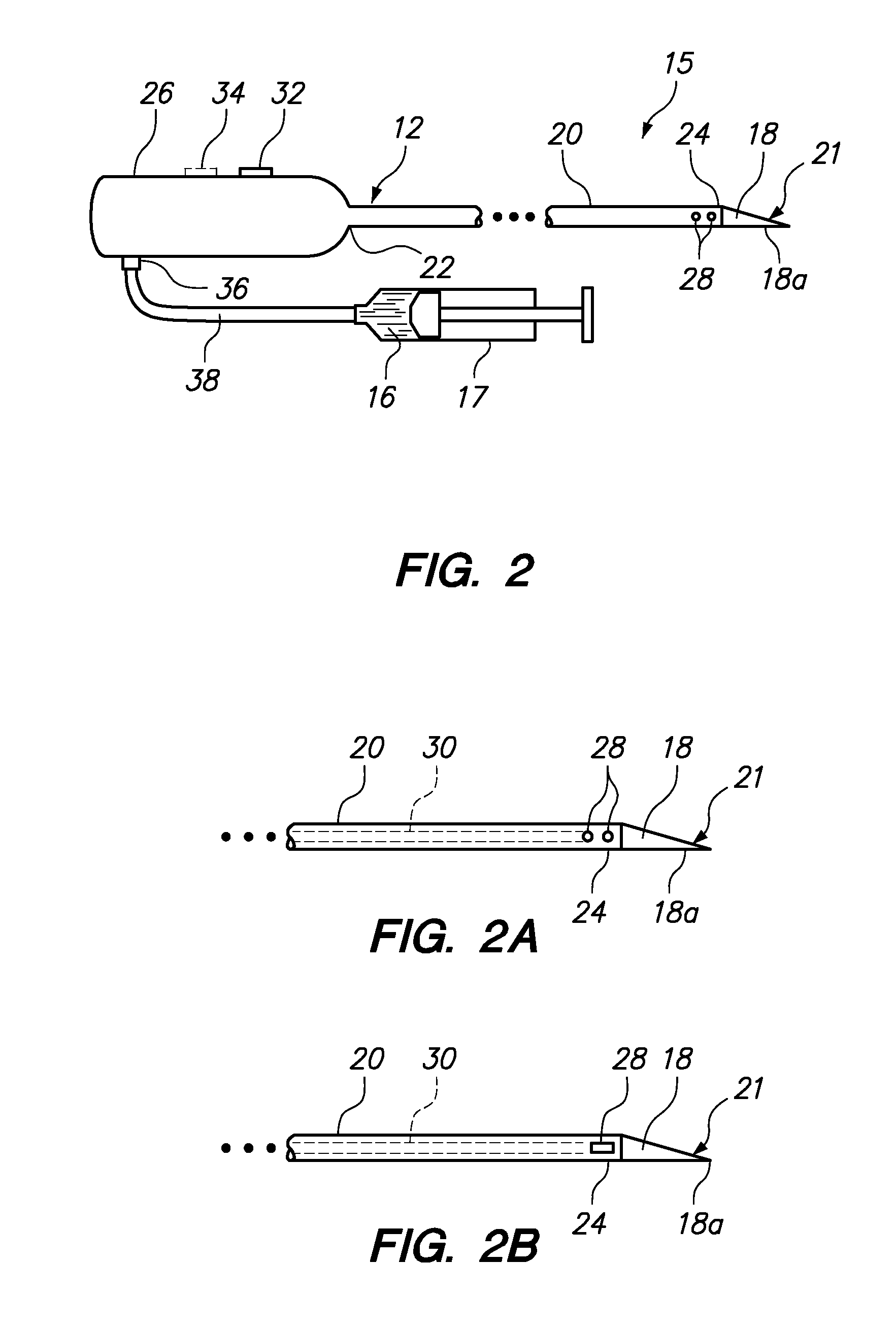 Method and apparatus for tissue resection