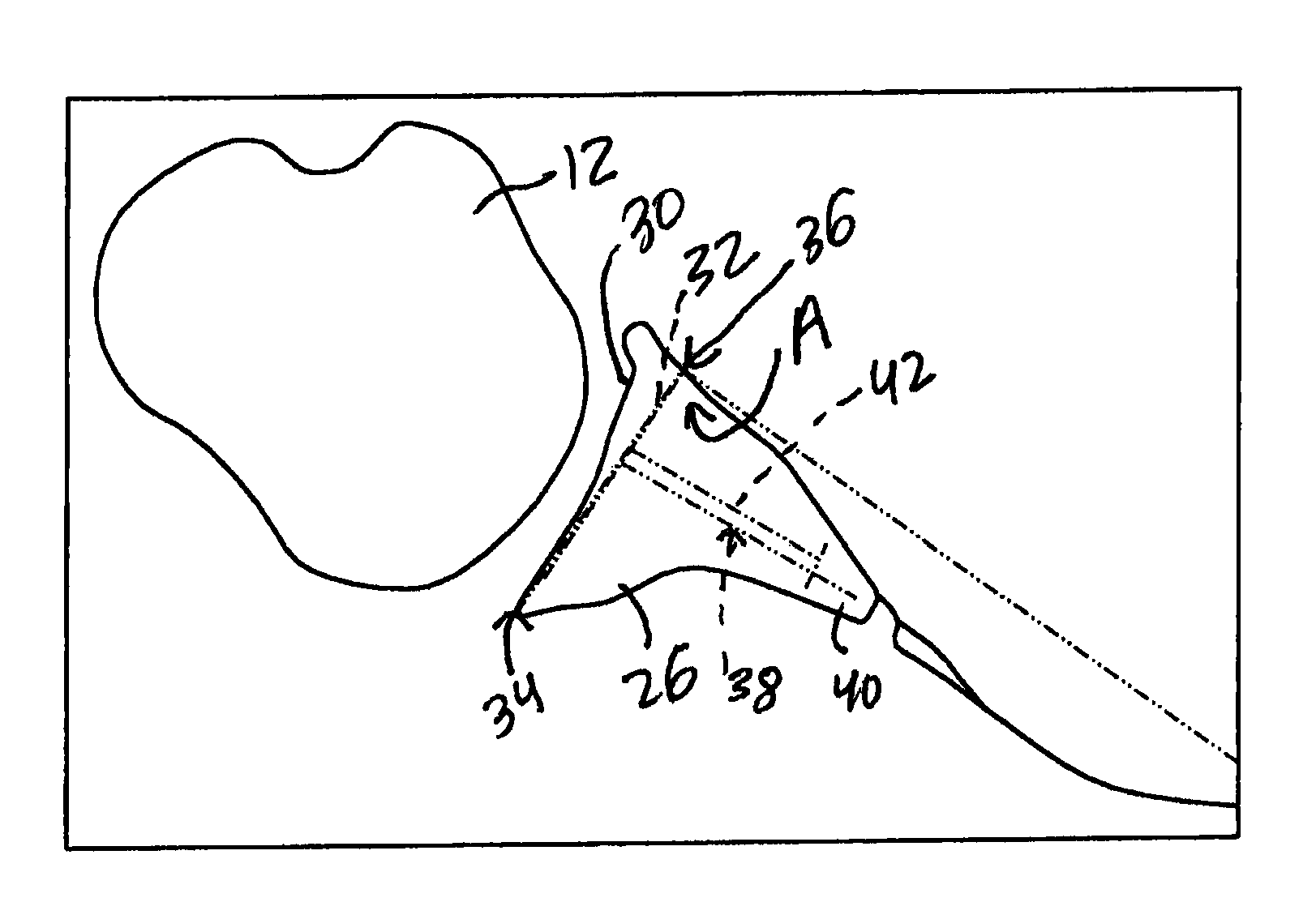 Method for optimization of joint arthroplasty component design