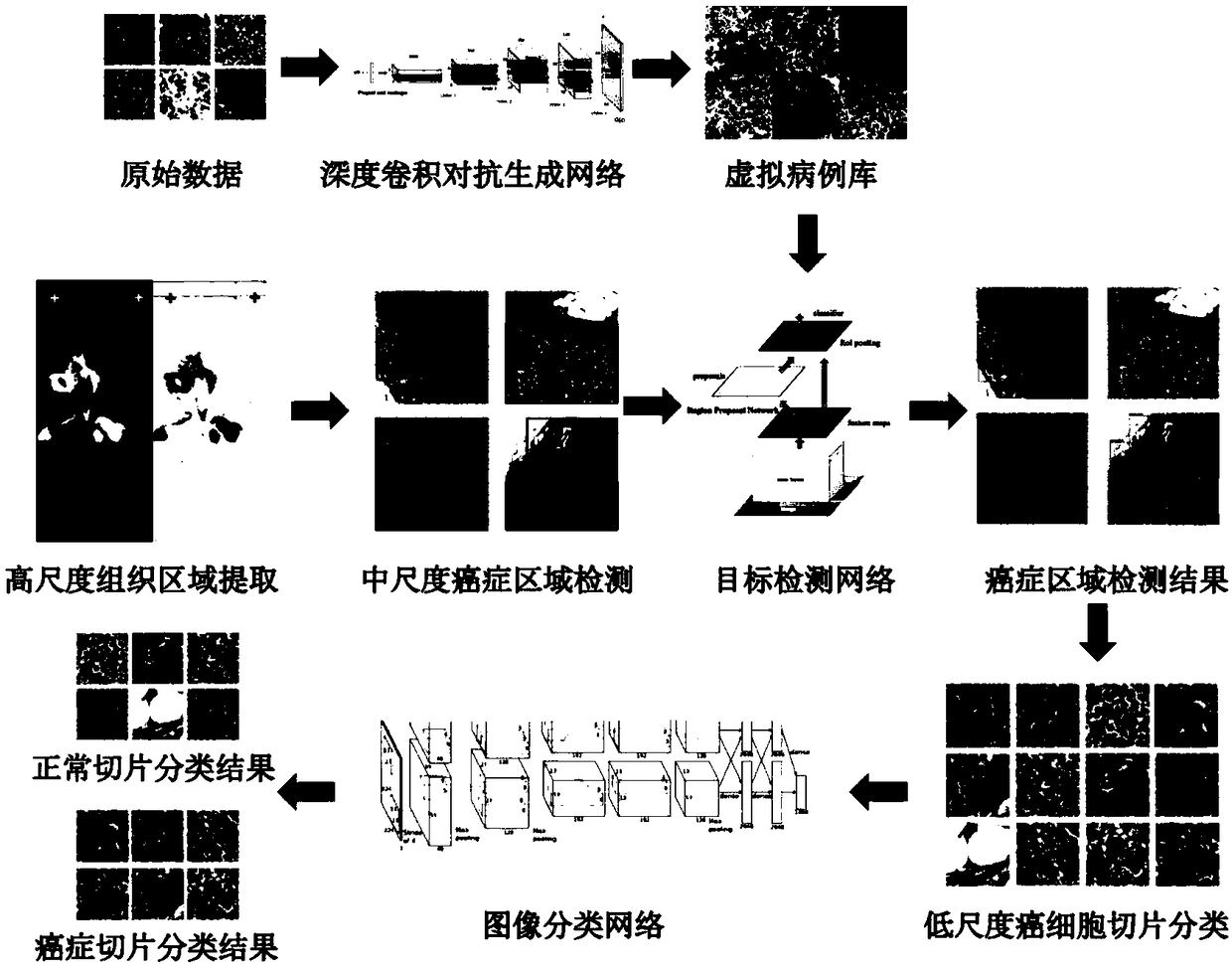 Method for constructing virtual case library of cancer pathological images and multi-scale cancer detection system based on convolutional neural network