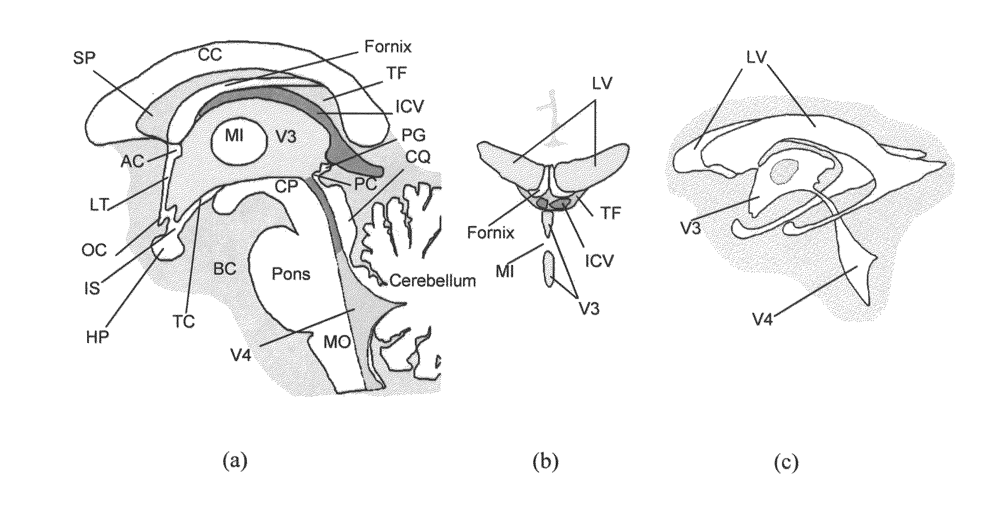 Method and system for anatomy structure segmentation and modeling in an image