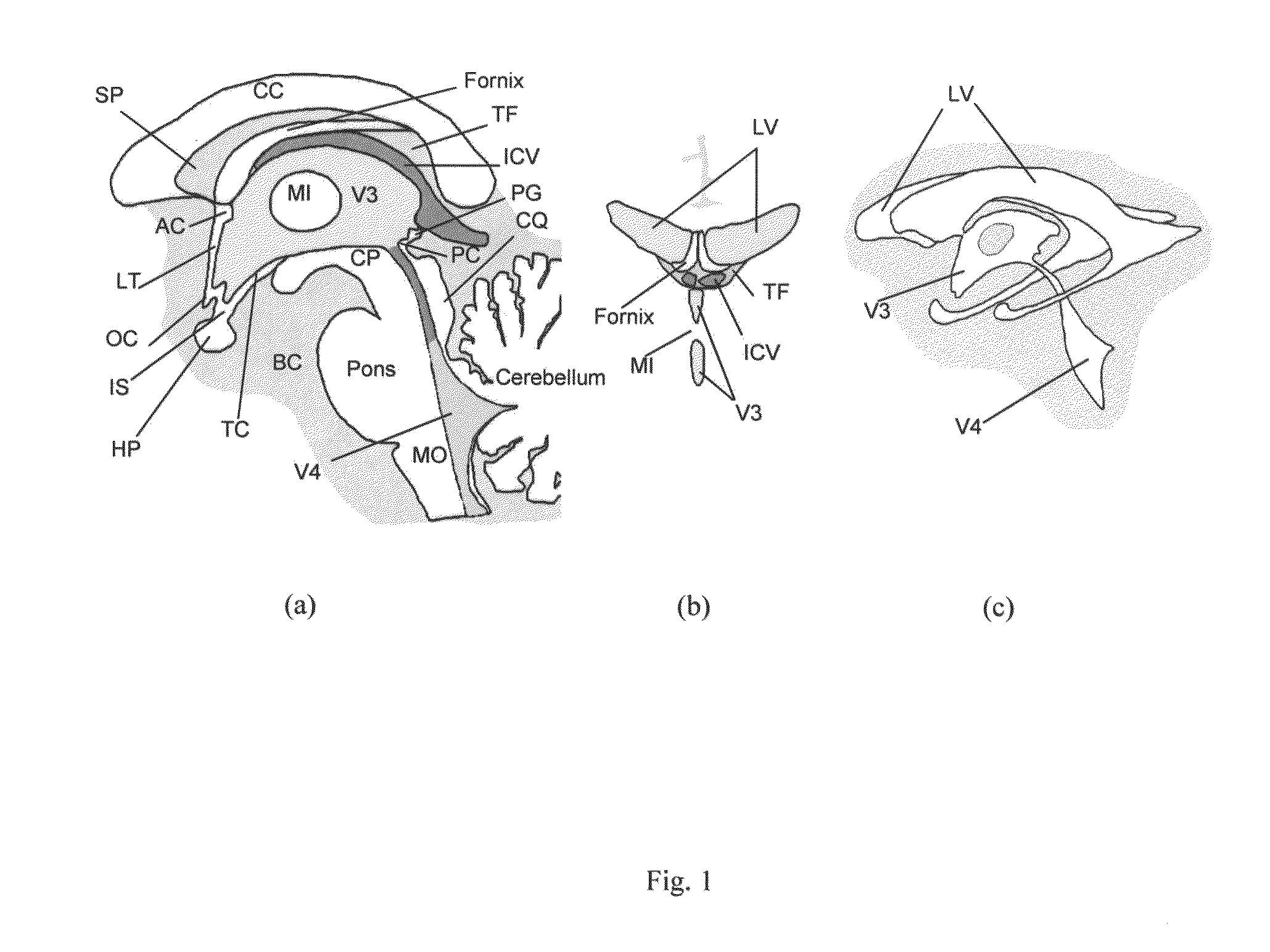 Method and system for anatomy structure segmentation and modeling in an image