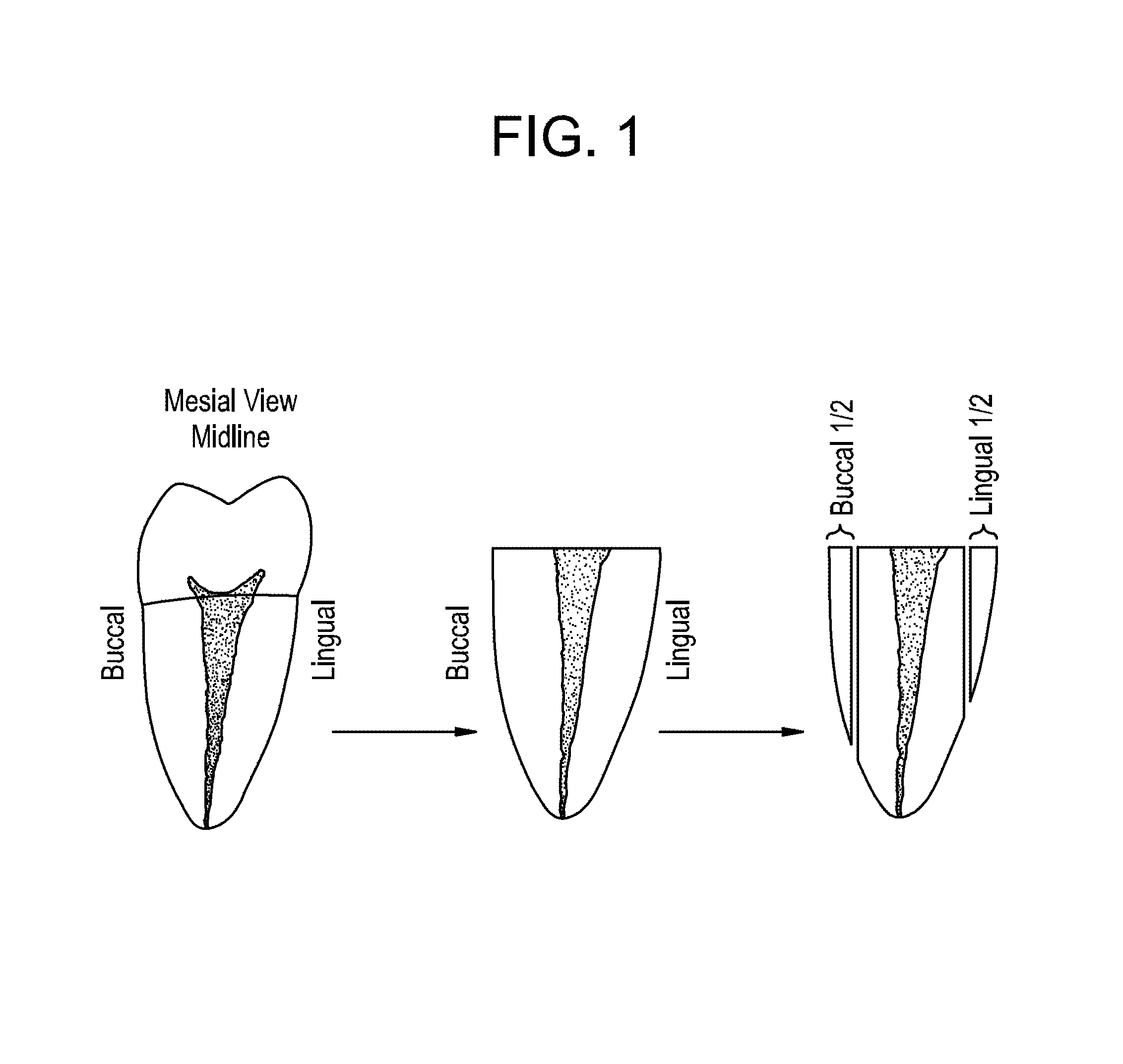 Anti-bacterial and mineralizing calcium phosphate compositions