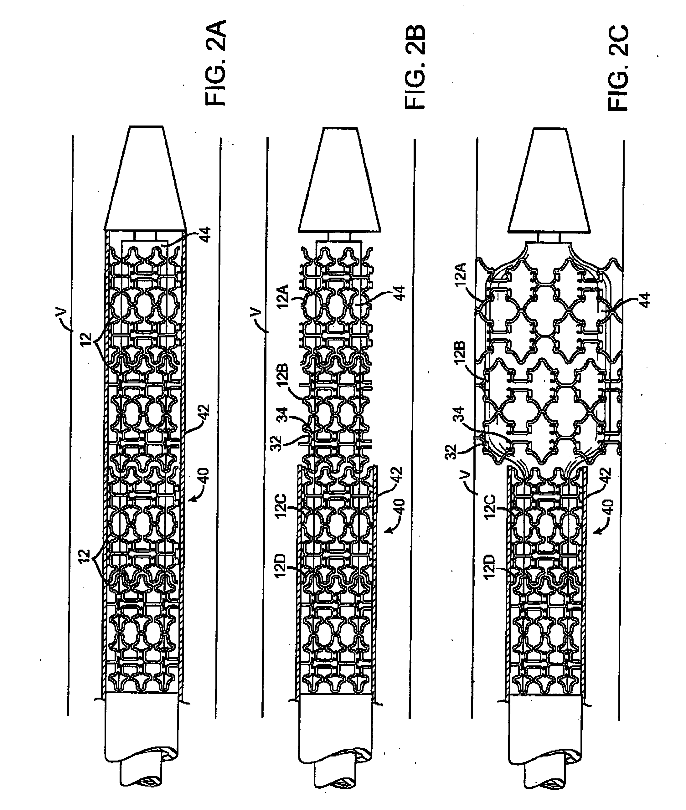 Self-constrained segmented stents and methods for their deployment