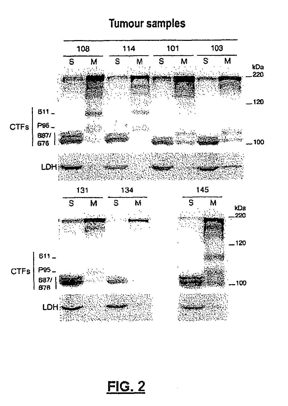 Method for diagnosing cancers expressing the HER2 receptor or its truncated variants