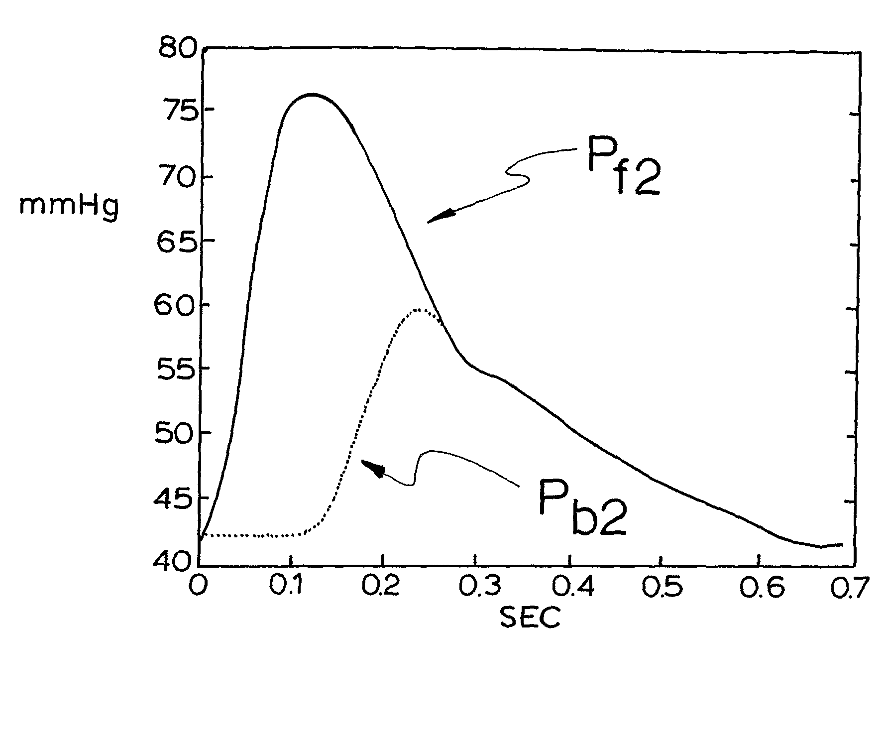 Method of estimating pulse wave velocity