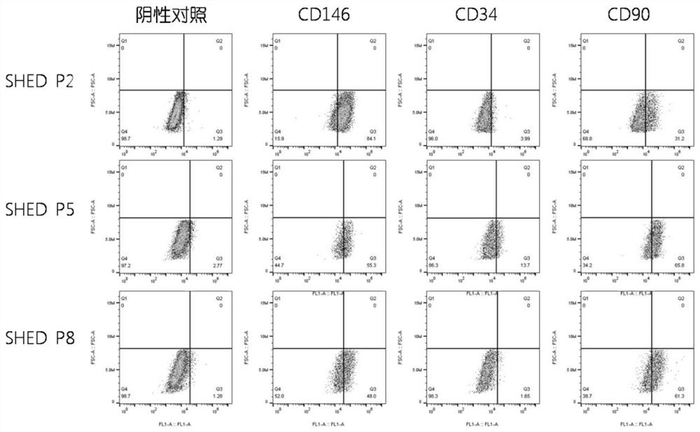 A method for isolating, culturing and neurally directed differentiation of dental pulp stem cells from deciduous teeth