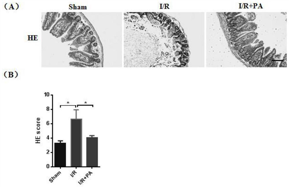 New use of pravastatin