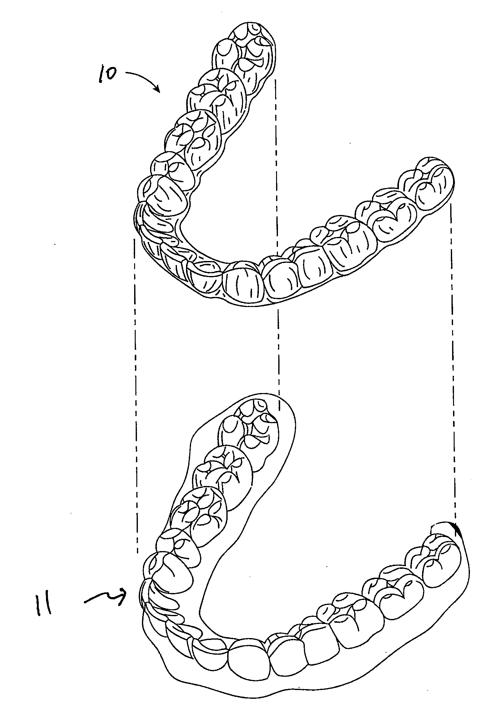 Orthodontic tooth movement device, systems and methods