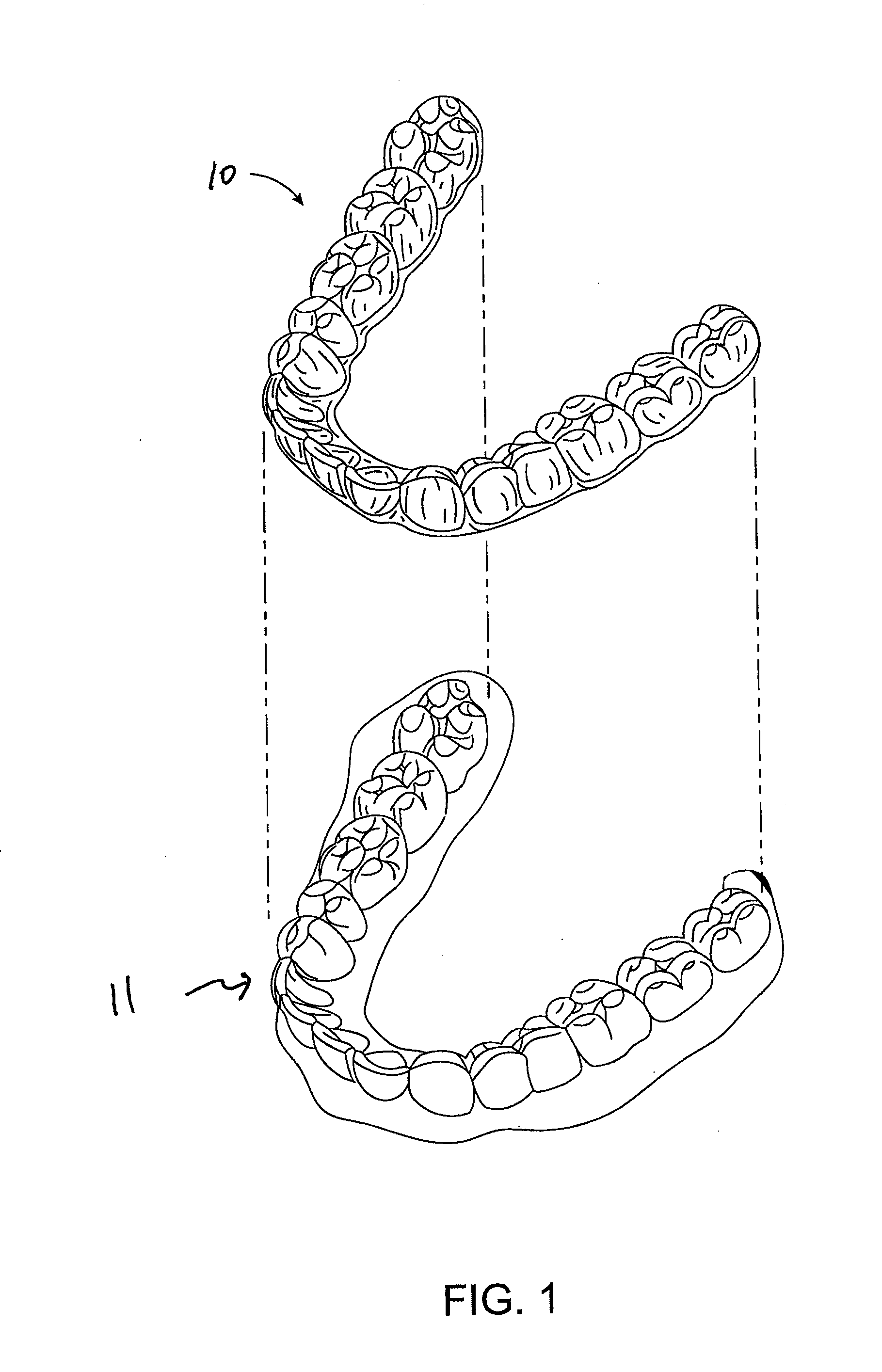 Orthodontic tooth movement device, systems and methods