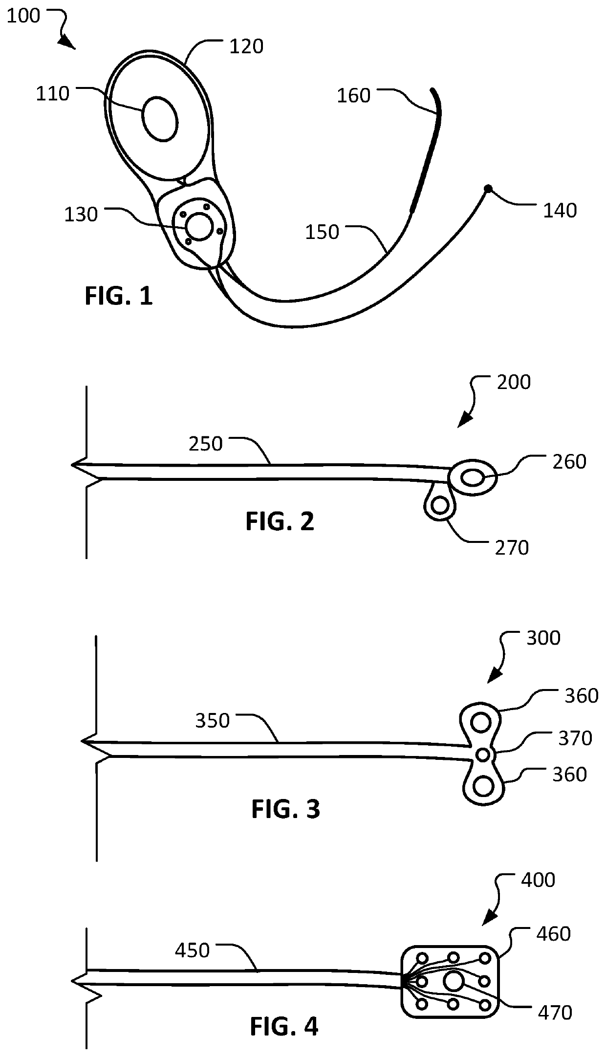 Devices and methods for treating tinnitus using electrical stimulation