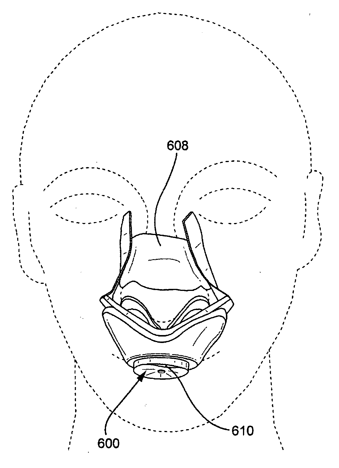 Respiratory resistance systems and methods