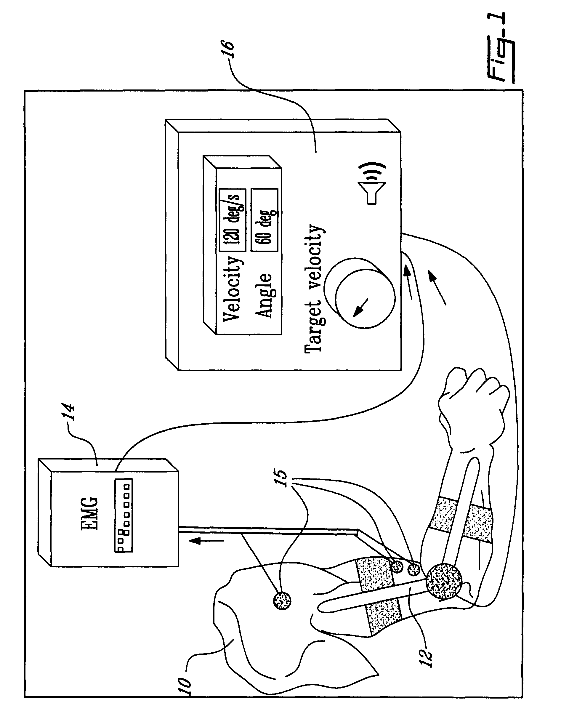 Method and apparatus for determining spasticity