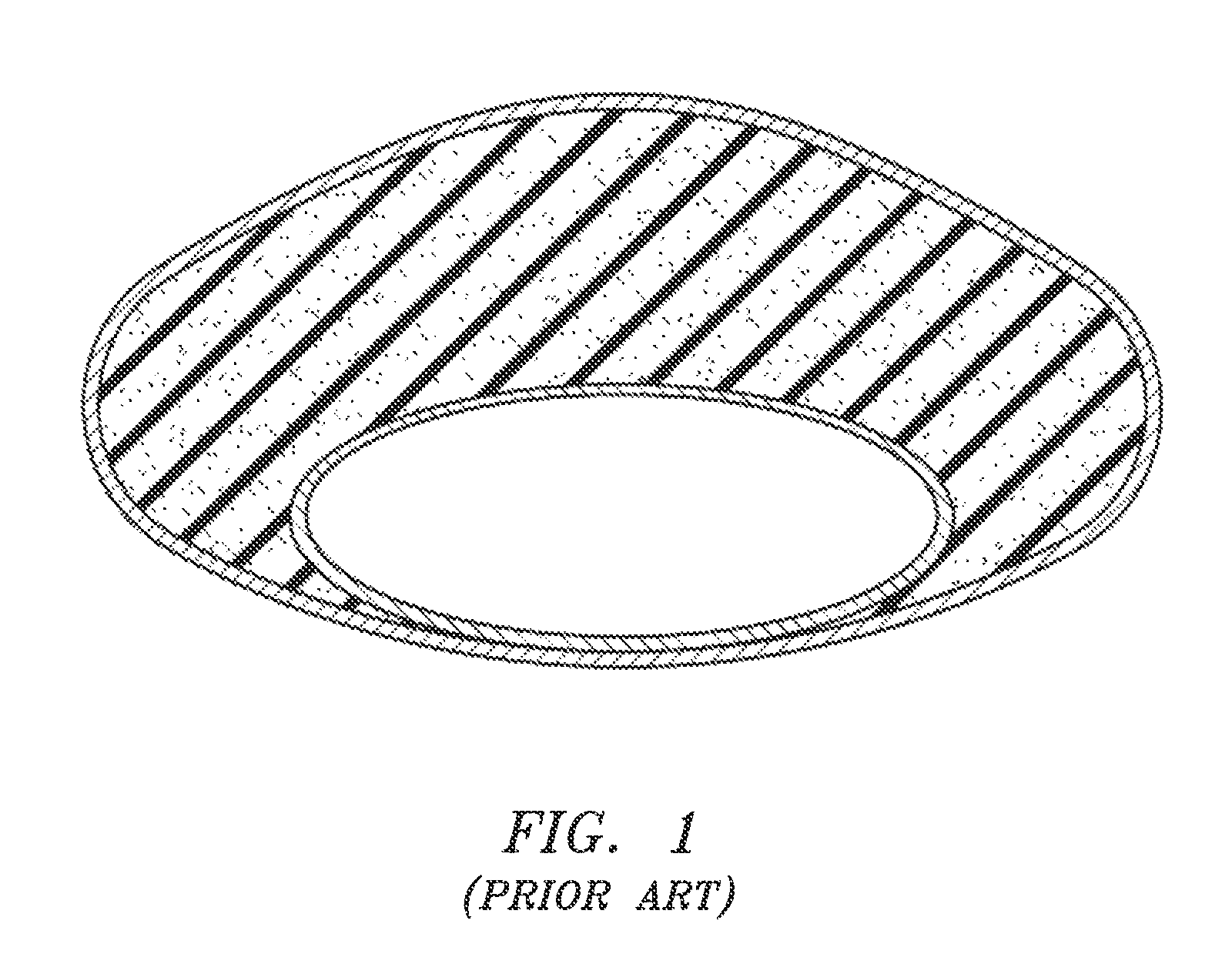 Gel-simulating and modulating buttress prosthesis