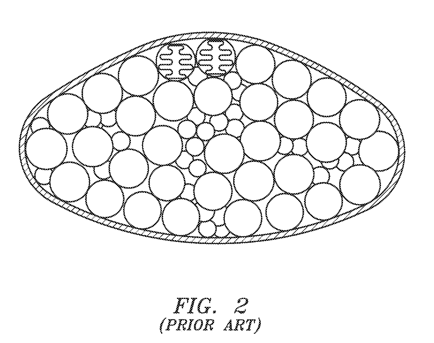 Gel-simulating and modulating buttress prosthesis