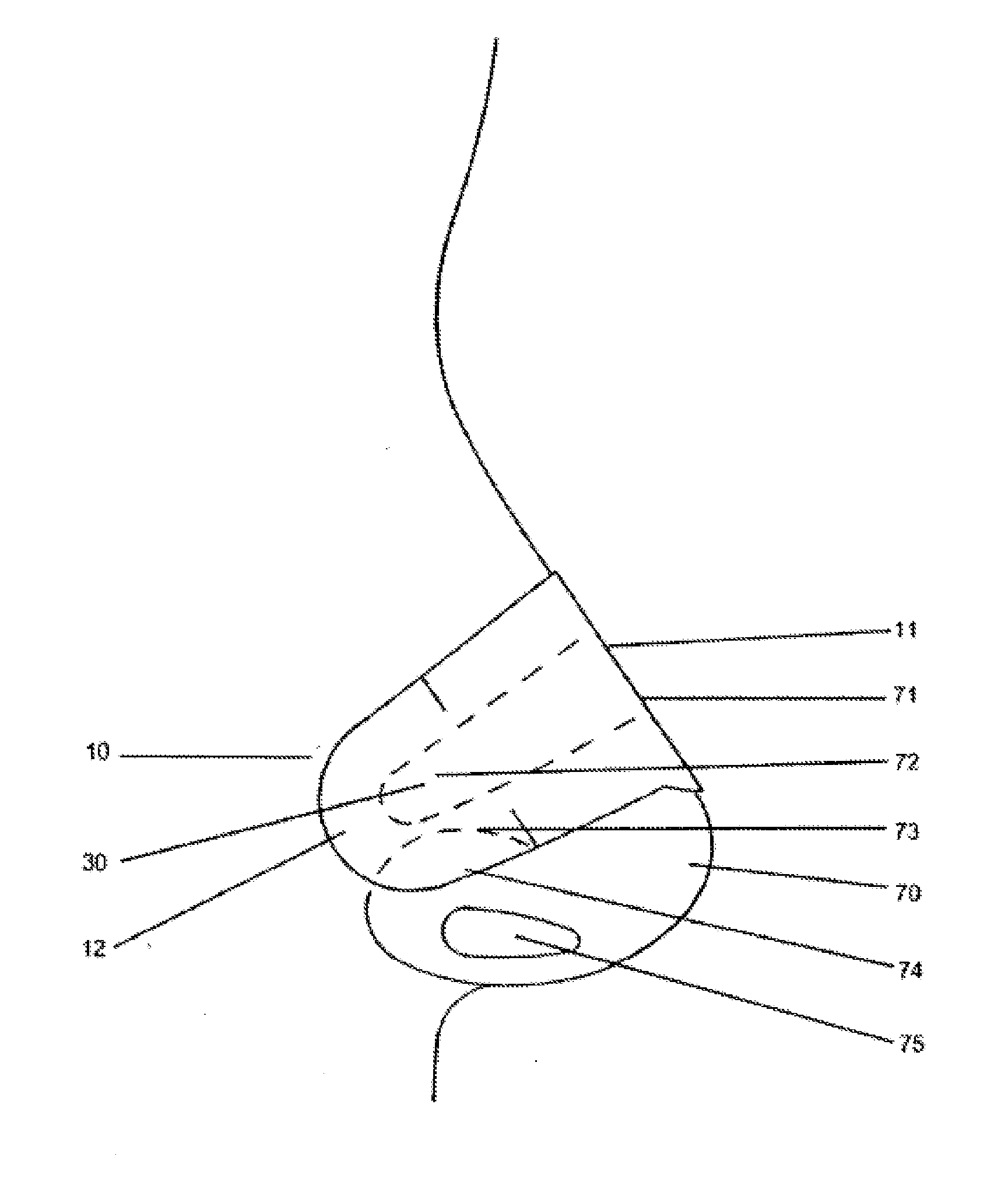 Nasal dilator with variable spring rate