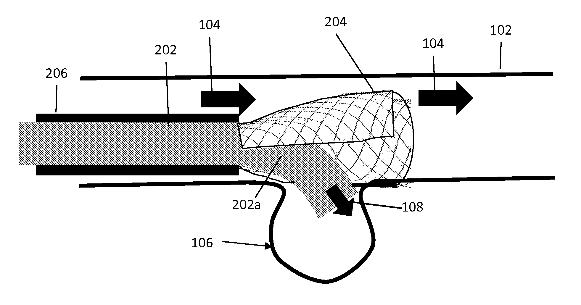 Flow Directional Infusion Device