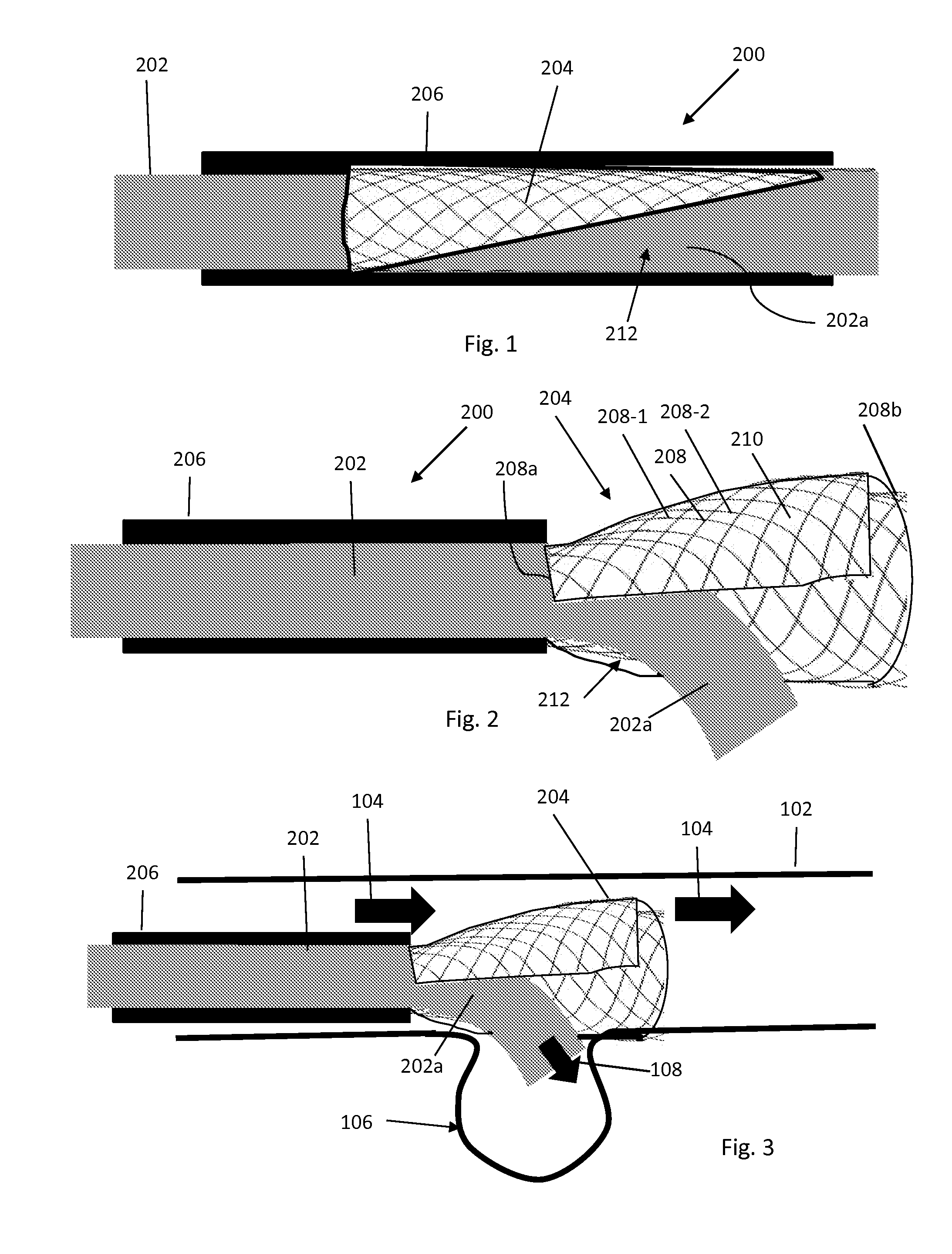 Flow Directional Infusion Device