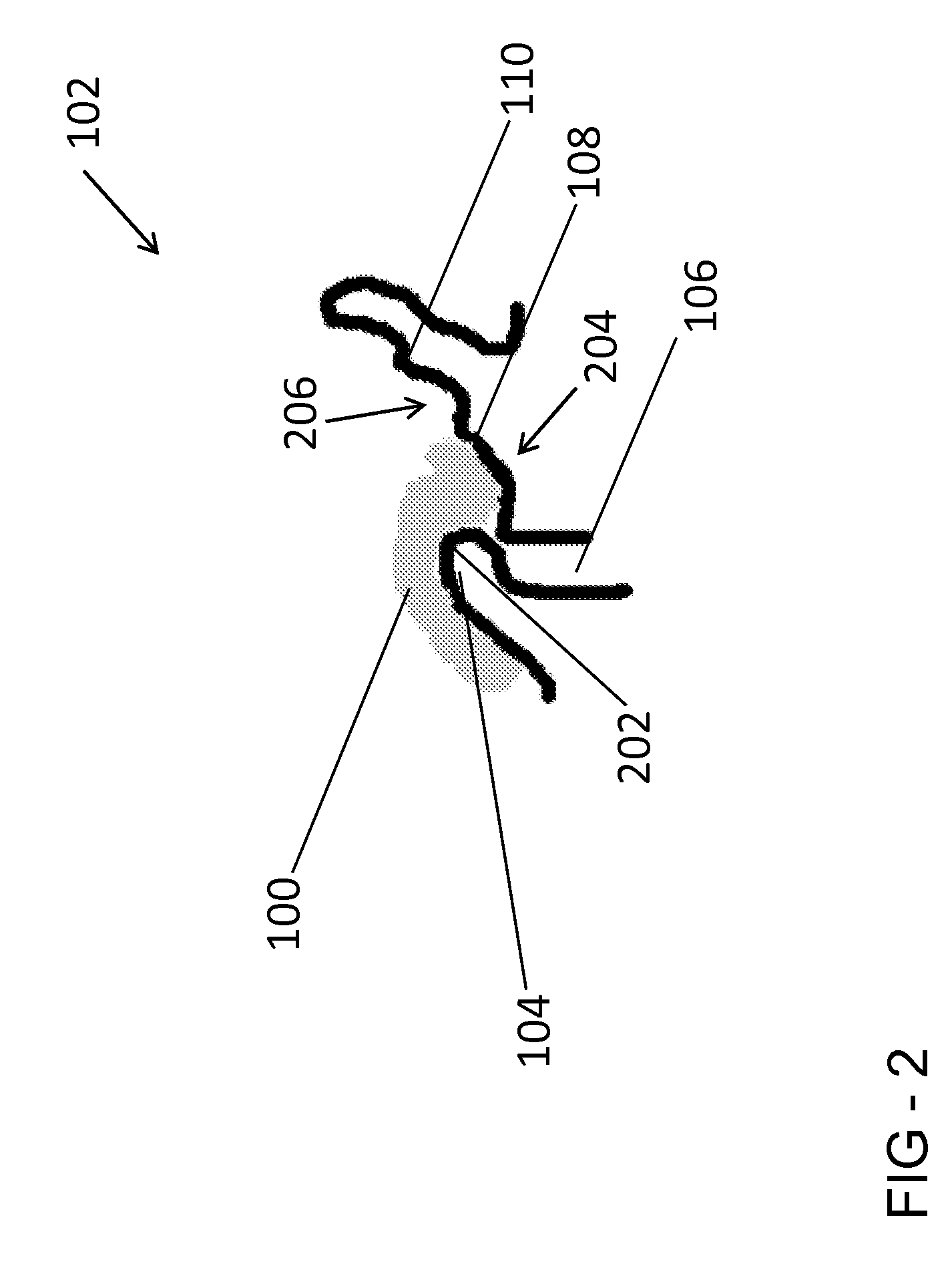 Method and apparatus for ear protection