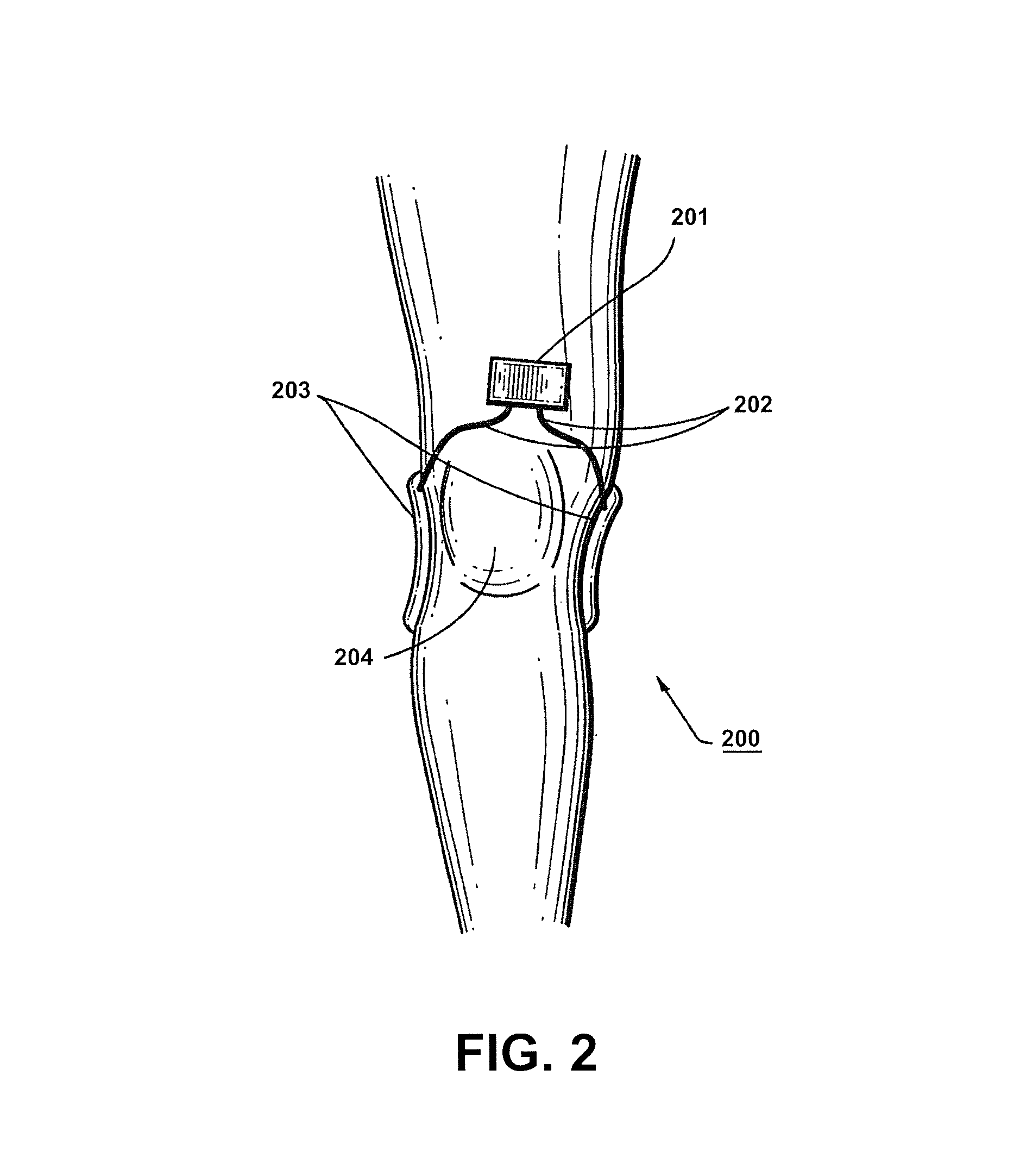 Apparatus and method for electromagnetic treatment of neurological pain