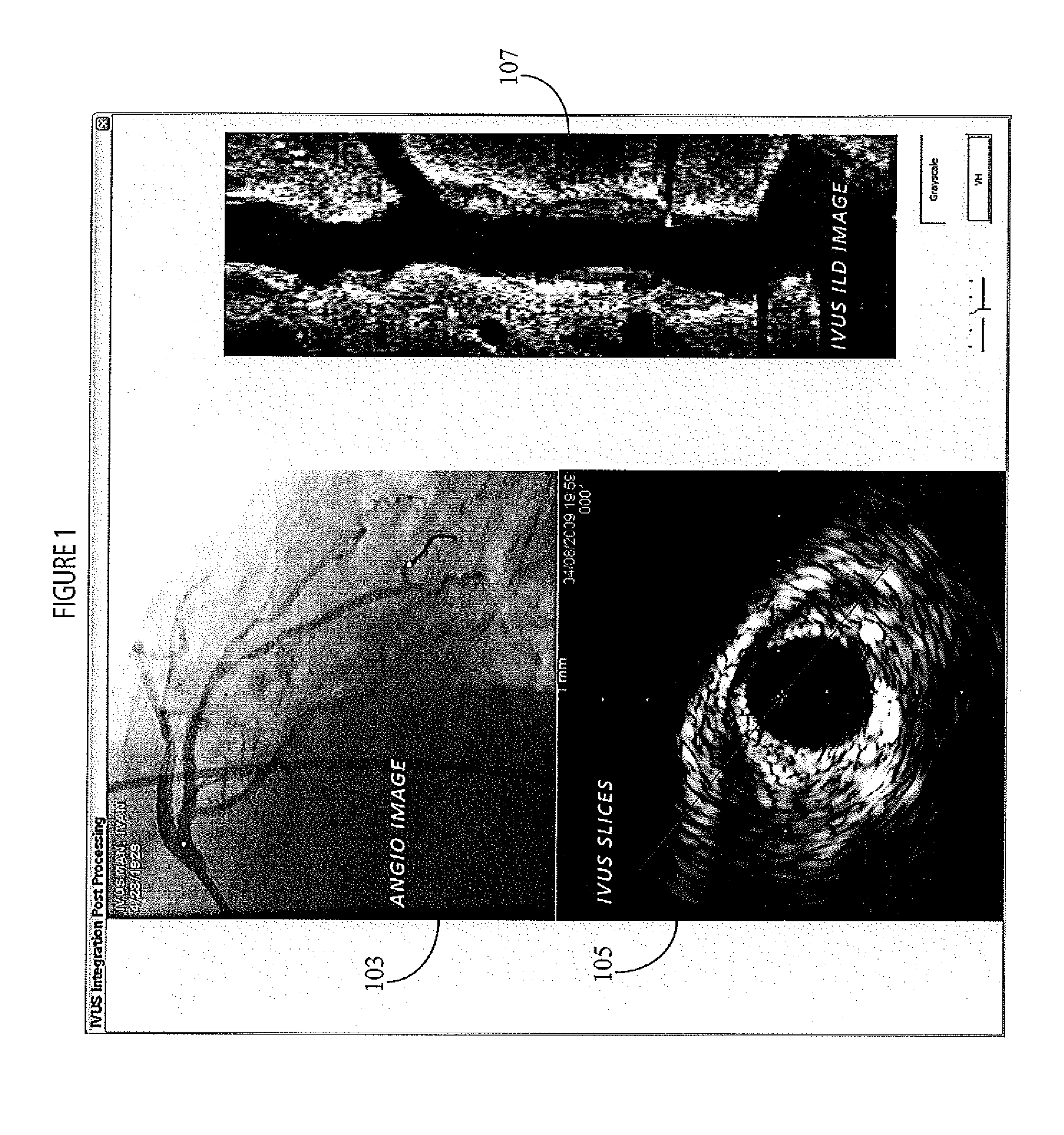 System for Processing Angiography and Ultrasound Image Data