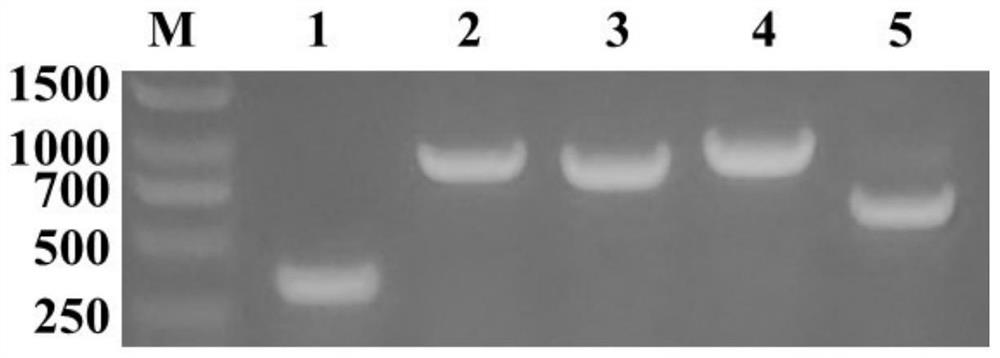 A recombinant bacterium with high hyaluronic acid production and its construction method and application