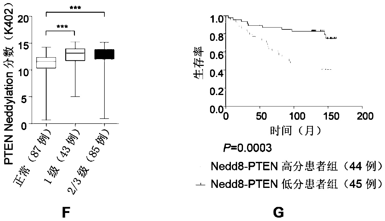 Invention and application of PTEN Nedd8 modification as new marker for breast cancer and specific antibody of modification