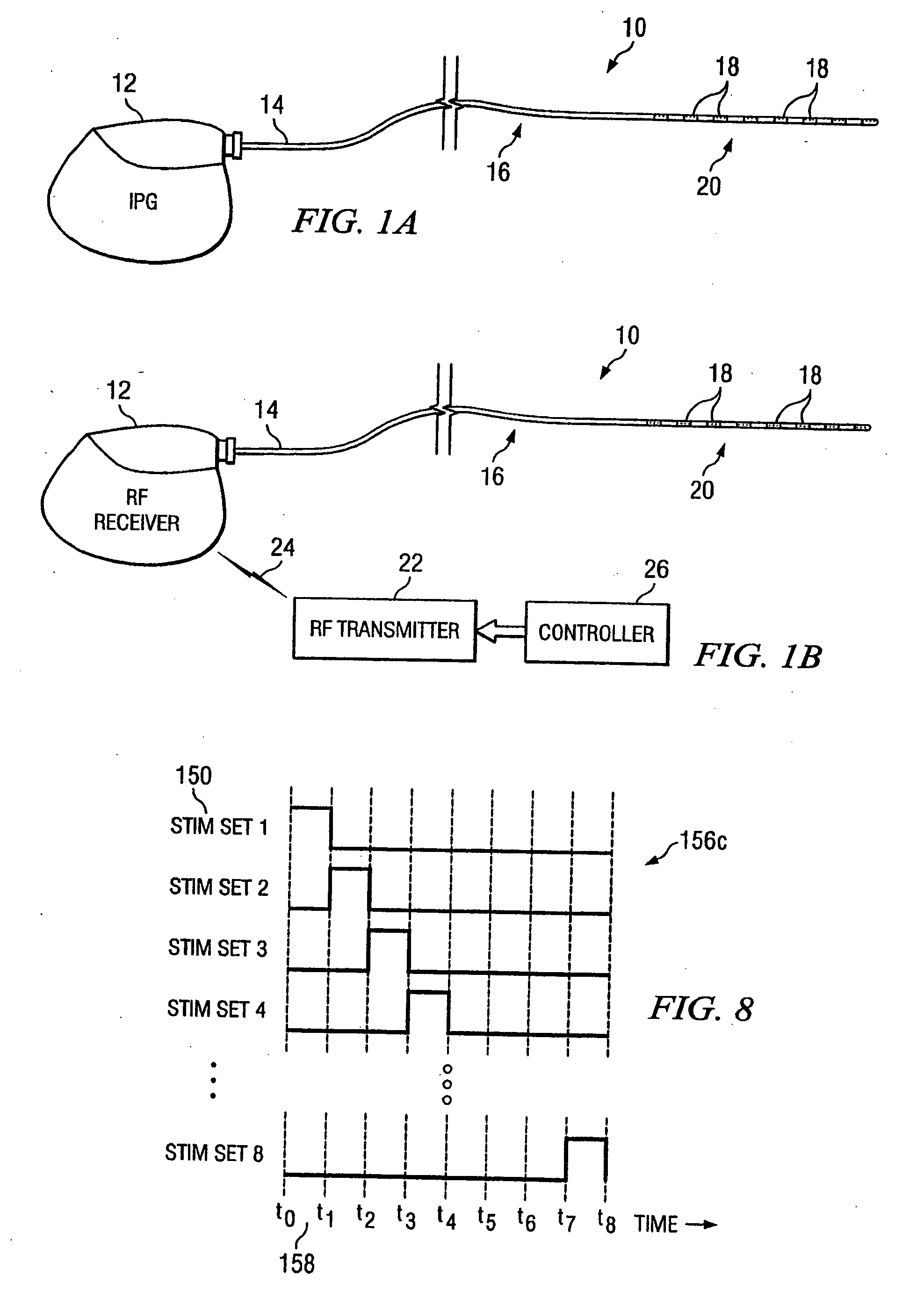 Electrical stimulation system and method for stimulating tissue in the brain to treat a neurological condition