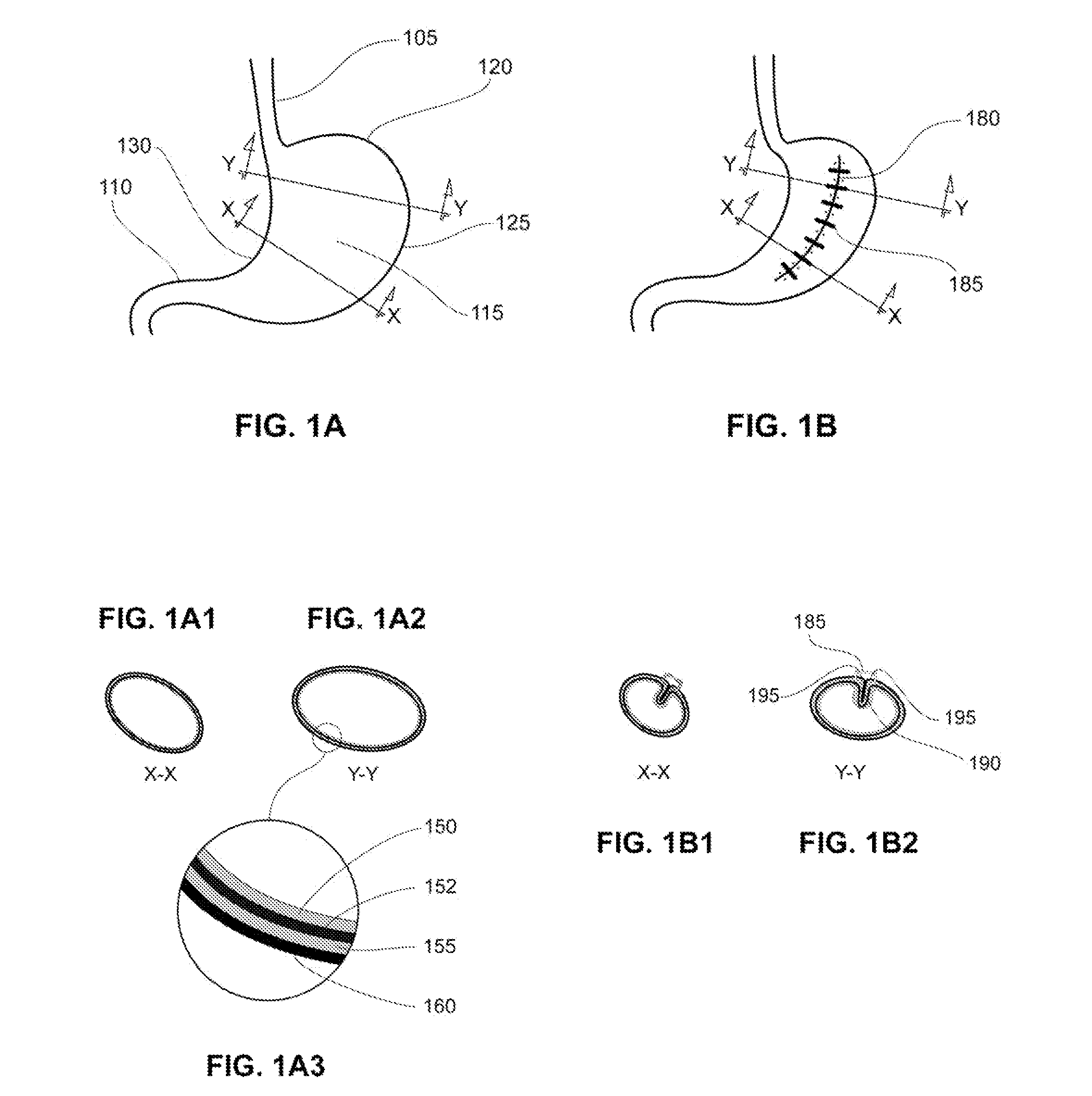 Devices for engaging, approximating and fastening tissue