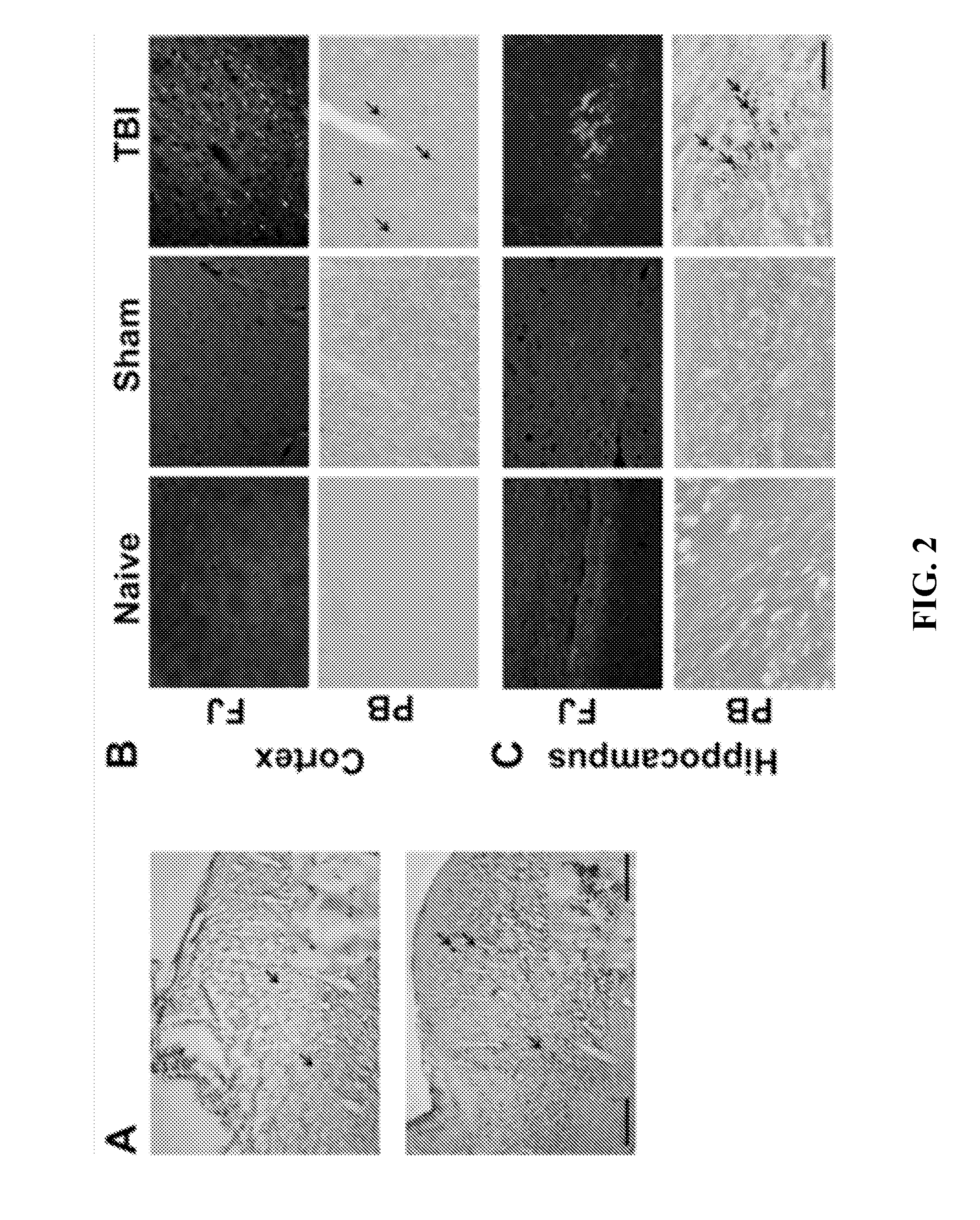 Methods of Using Multilayer Magnetic Micelle Compositions
