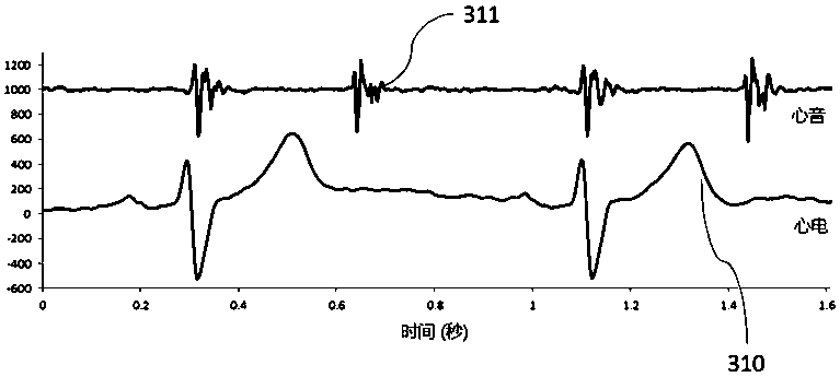 A wearable heart sound and ECG characteristic information collection and monitoring system