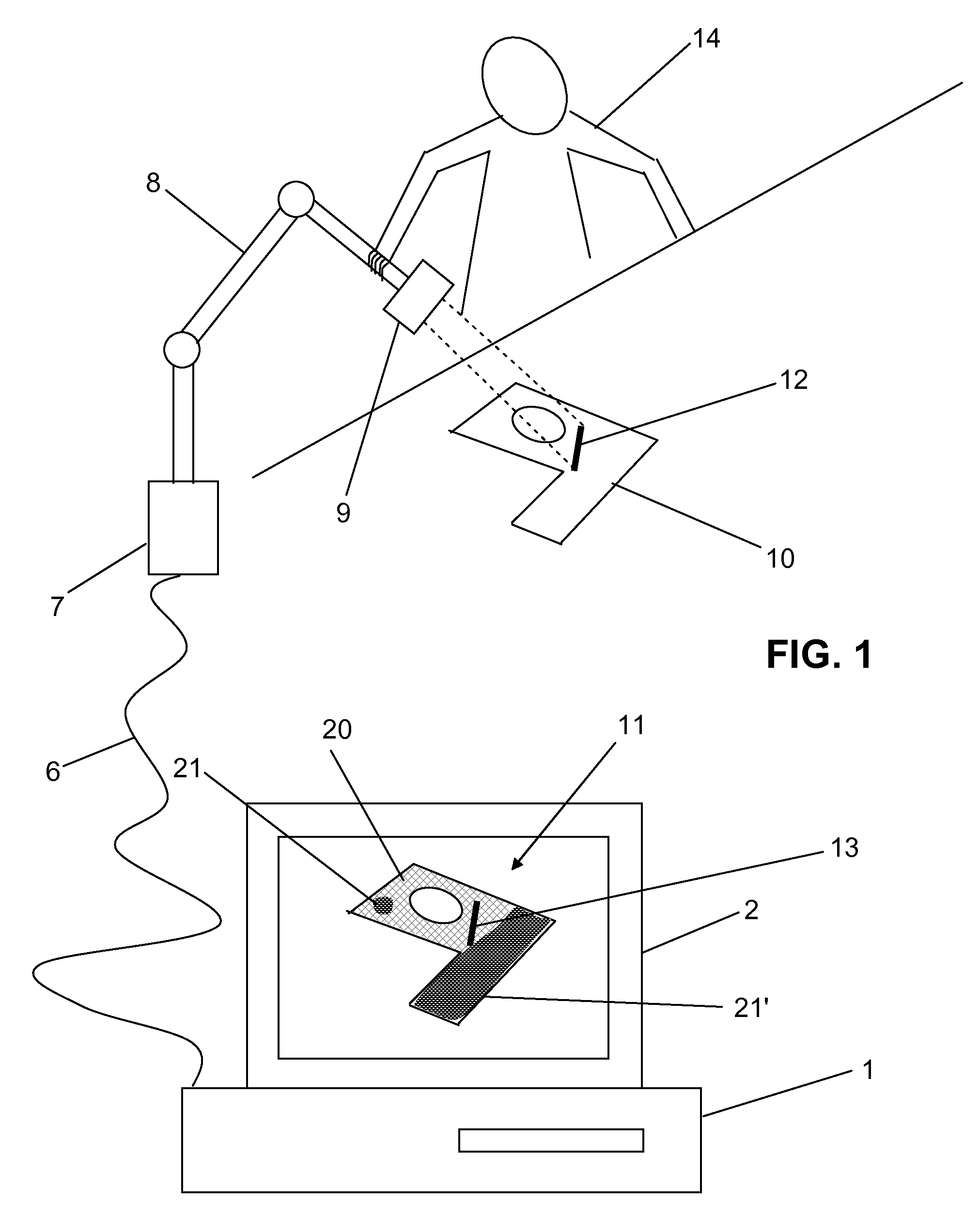 Method and computer program for improving the dimensional acquisition of an object
