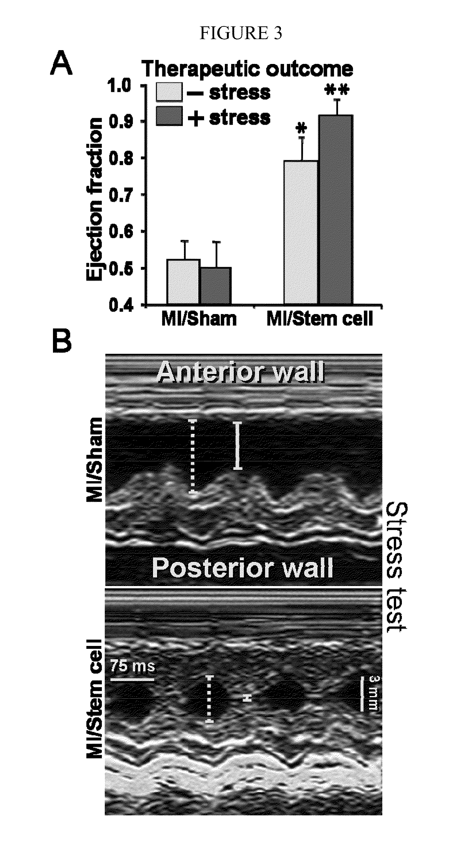 Compositions consisting essentially of TGF-β, BMP-2 FGF-4, leukemia inhibitory factor, IGF-1, IL-6 and H-α-thrombin