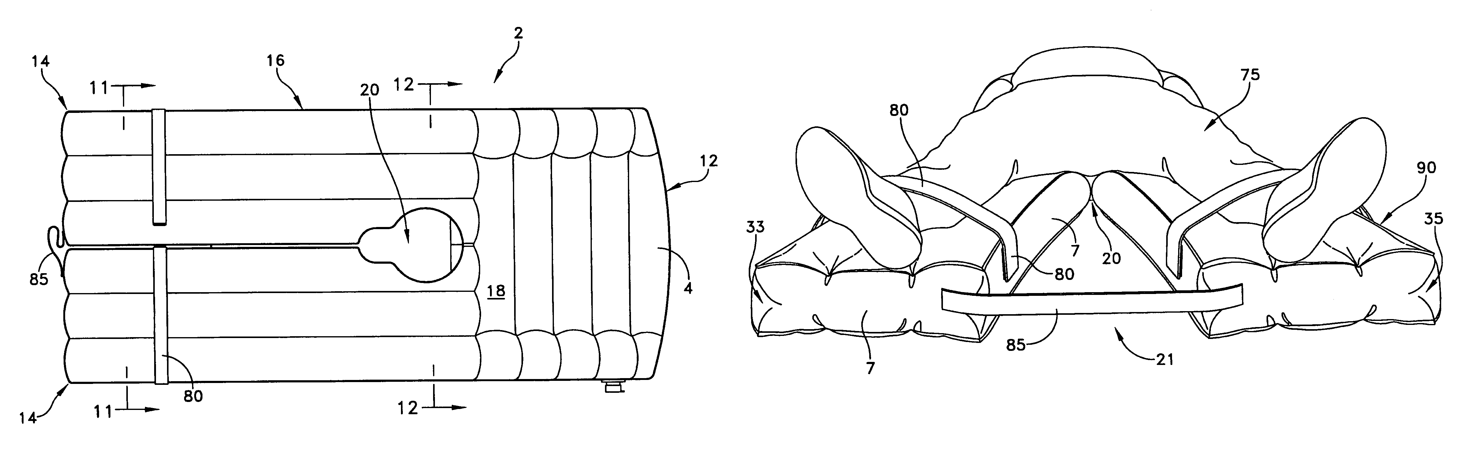 Inflatable transfer mattress