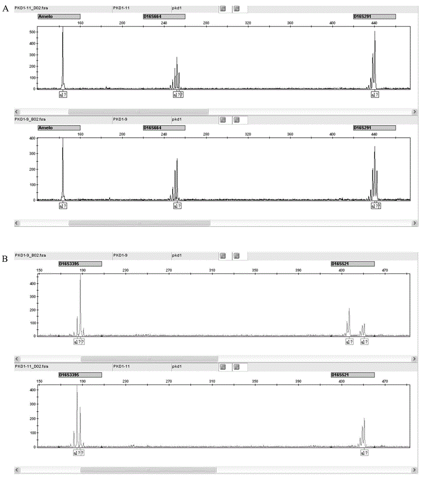 STR locus of PKD1 gene and application thereof