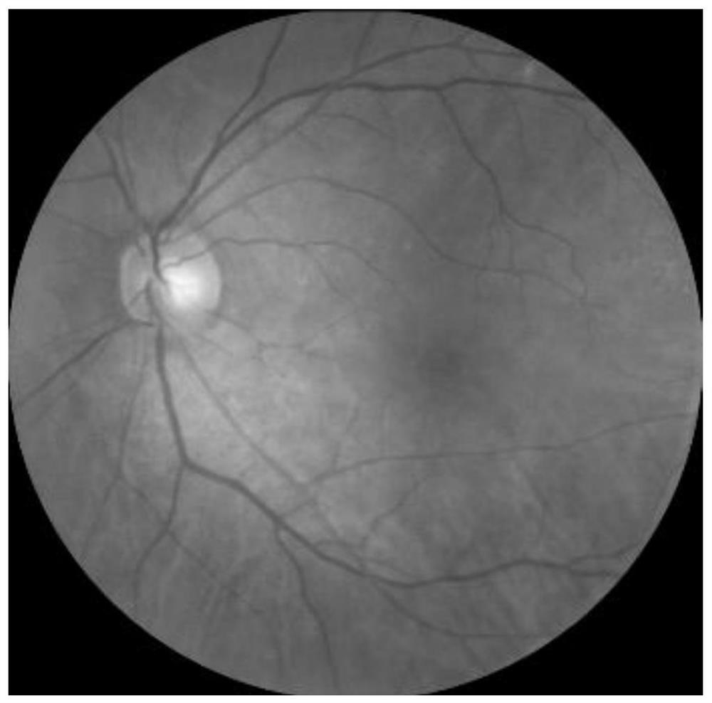 Fundus identification model training method, fundus identification method and device