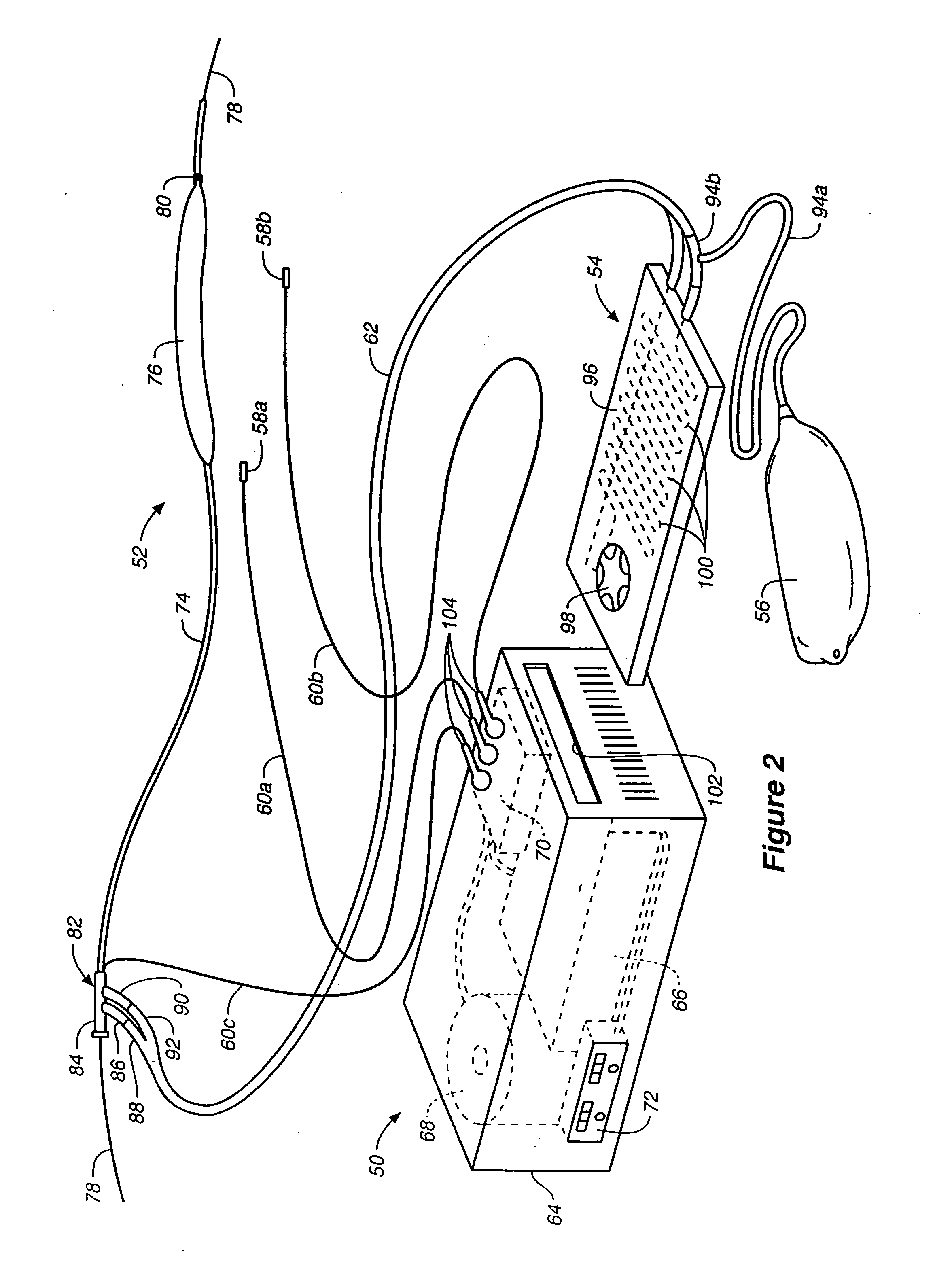 Method and system for control of a patient's body temperature by way of a transluminally insertable heat exchange catheter