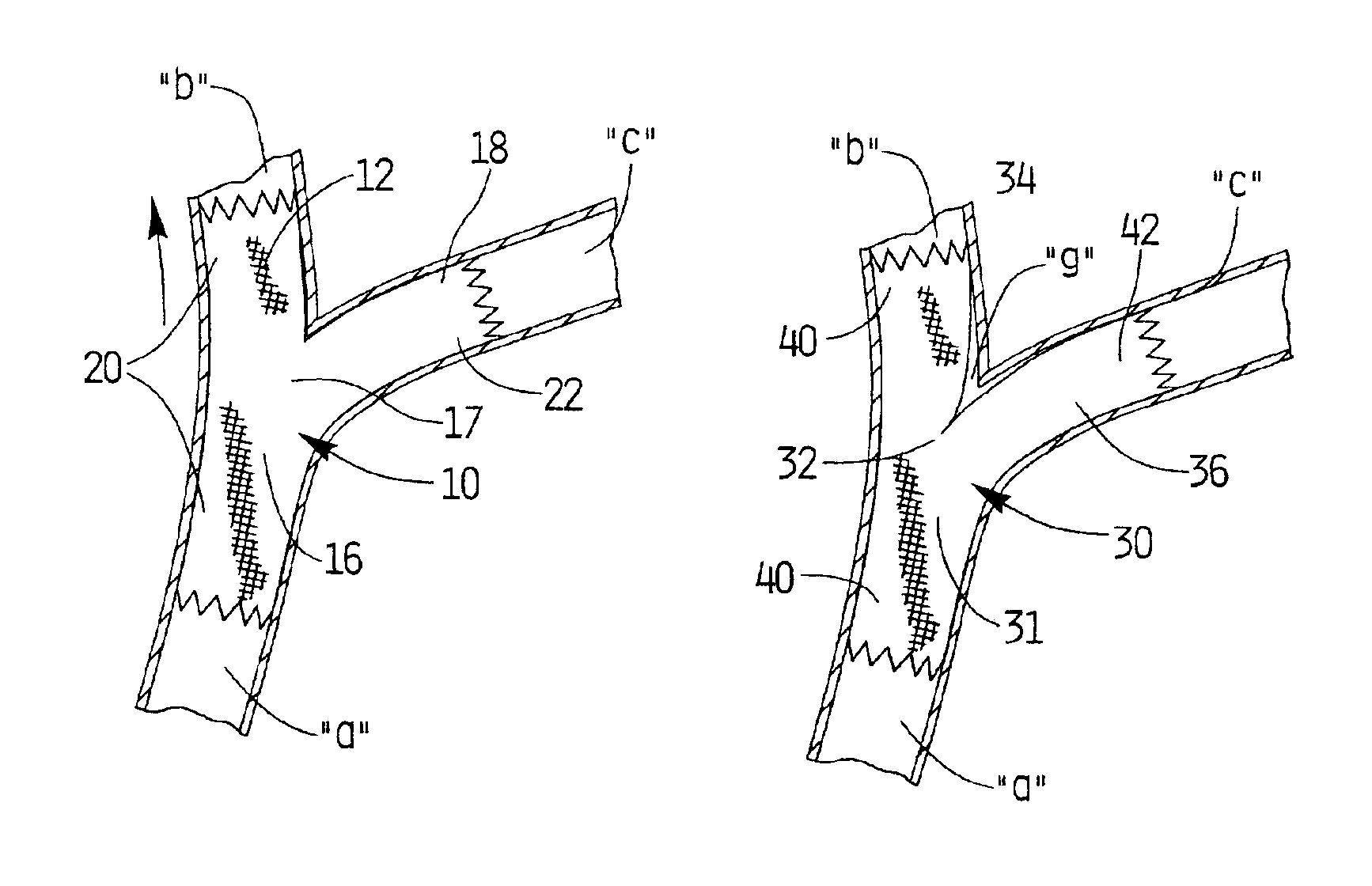 Methods of implanting covered stents with side branch