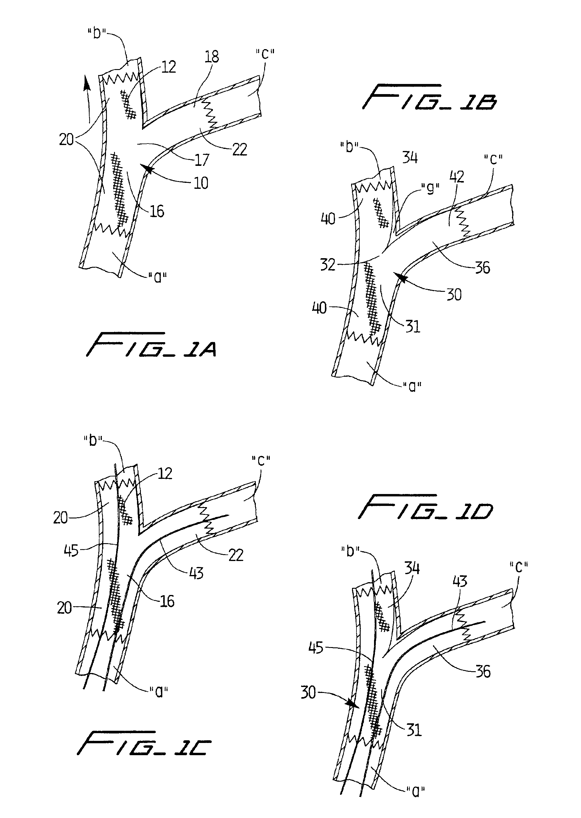 Methods of implanting covered stents with side branch