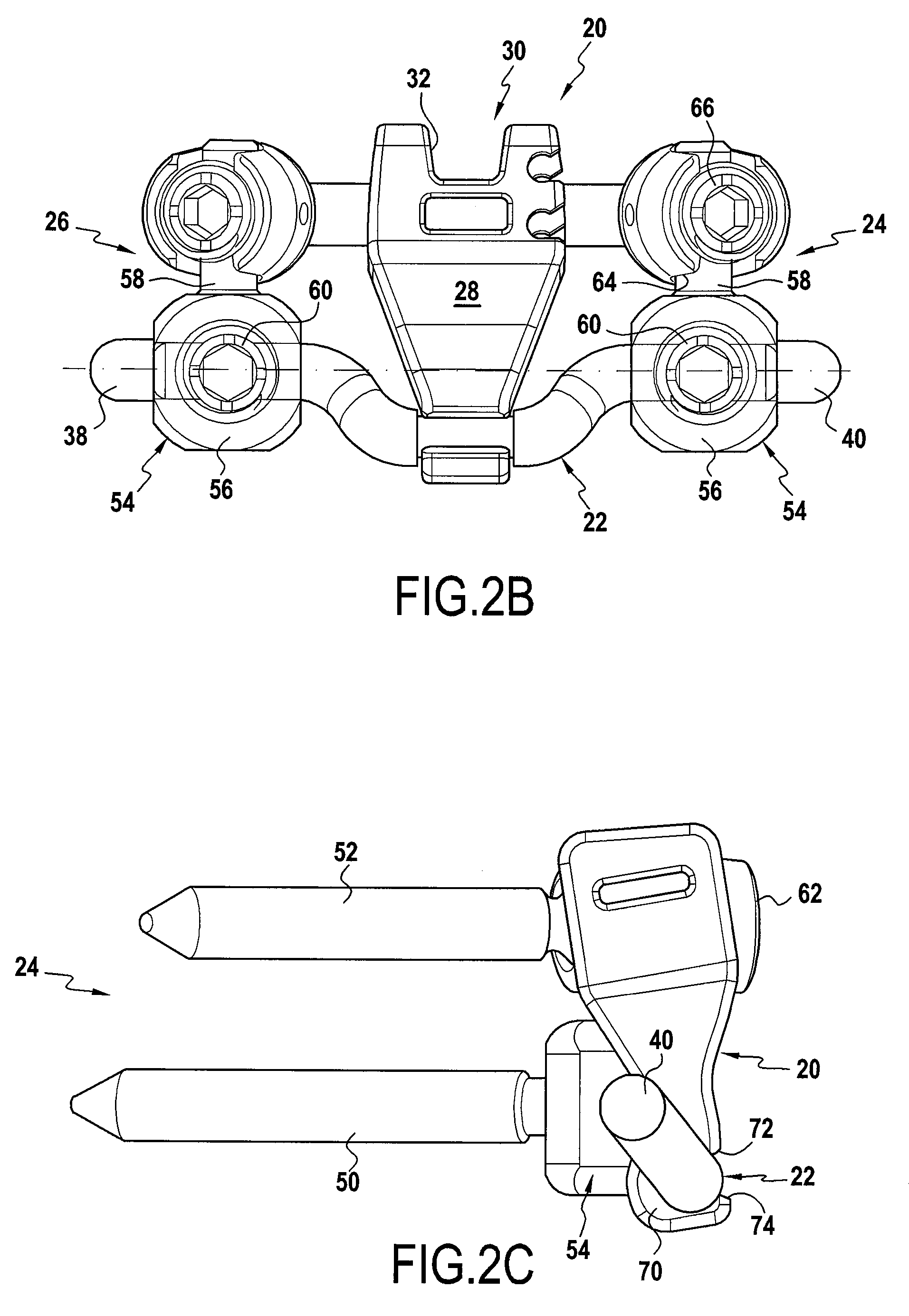 Intervertebral implant for lumbosacral joint