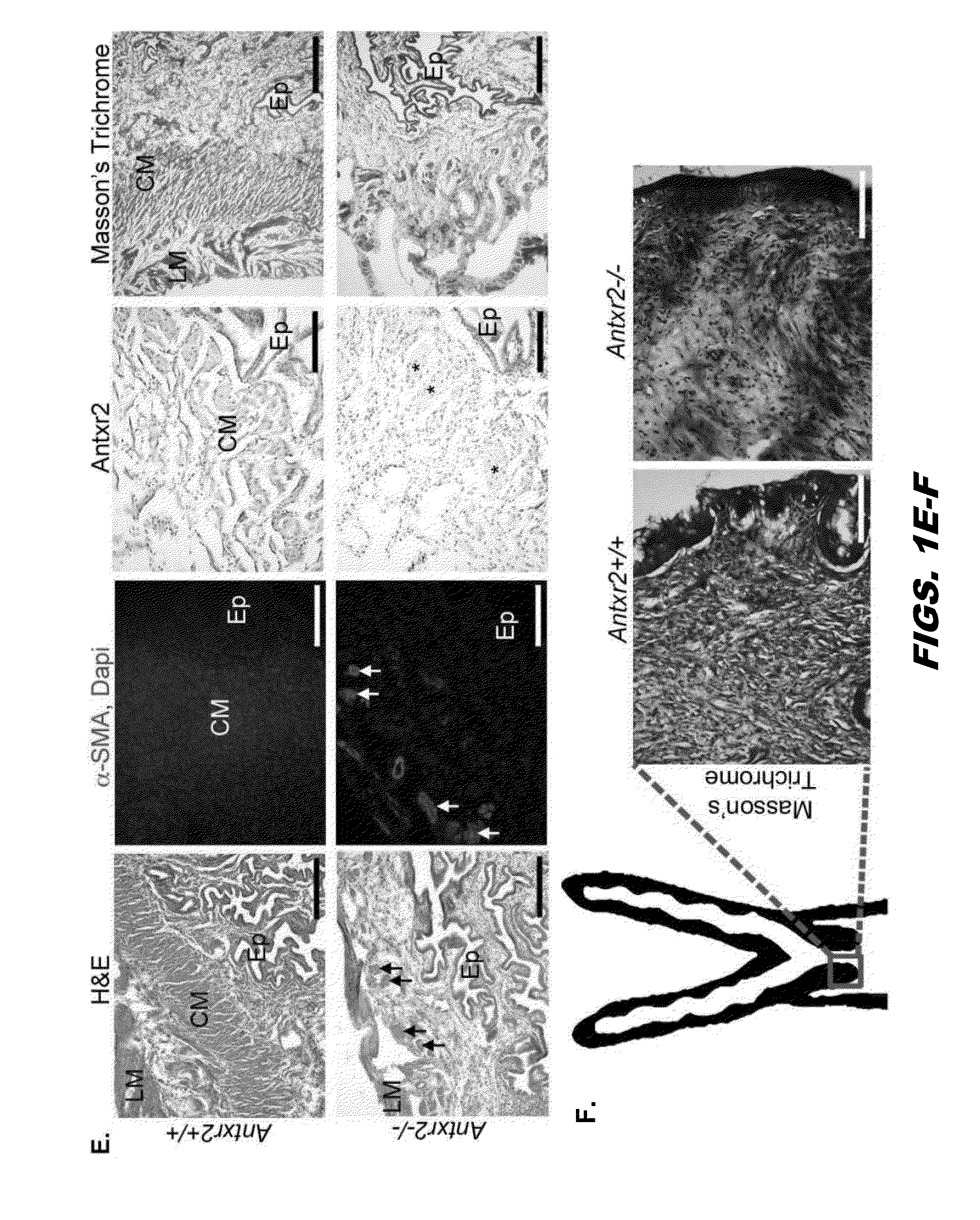 Fusion polypeptides and methods of use thereof