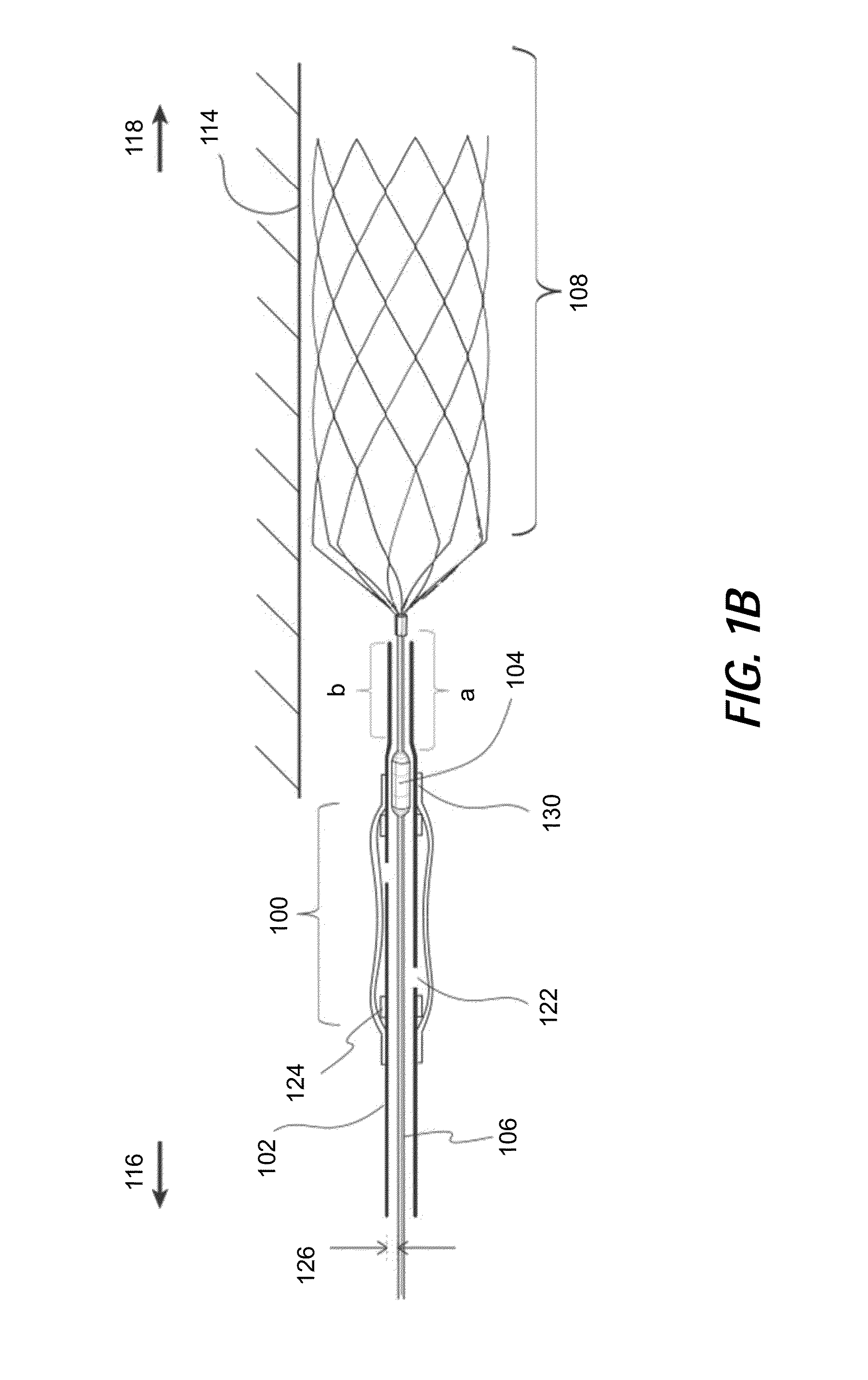 Methods, devices, and systems for postconditioning with clot removal