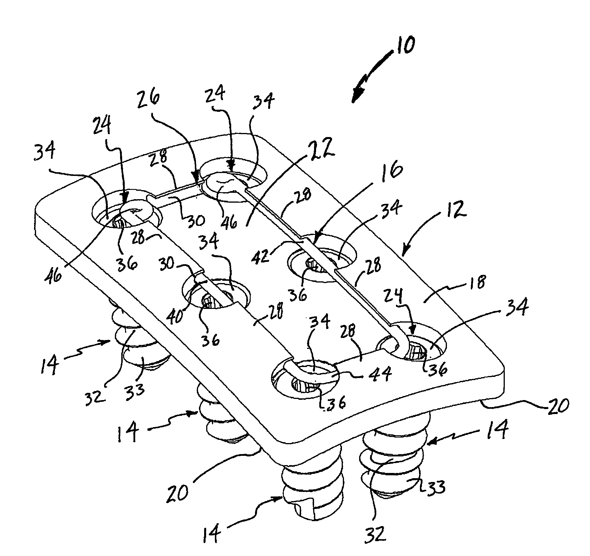 Surgical fixation system and related methods