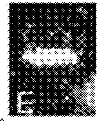 Compositions and Methods employing Wolbachia FtsZ as a target for Albendazole sulfone