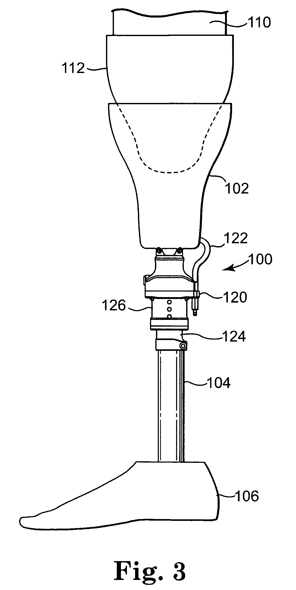 Vacuum pump with shock absorption and controlled rotation for prosthetic devices