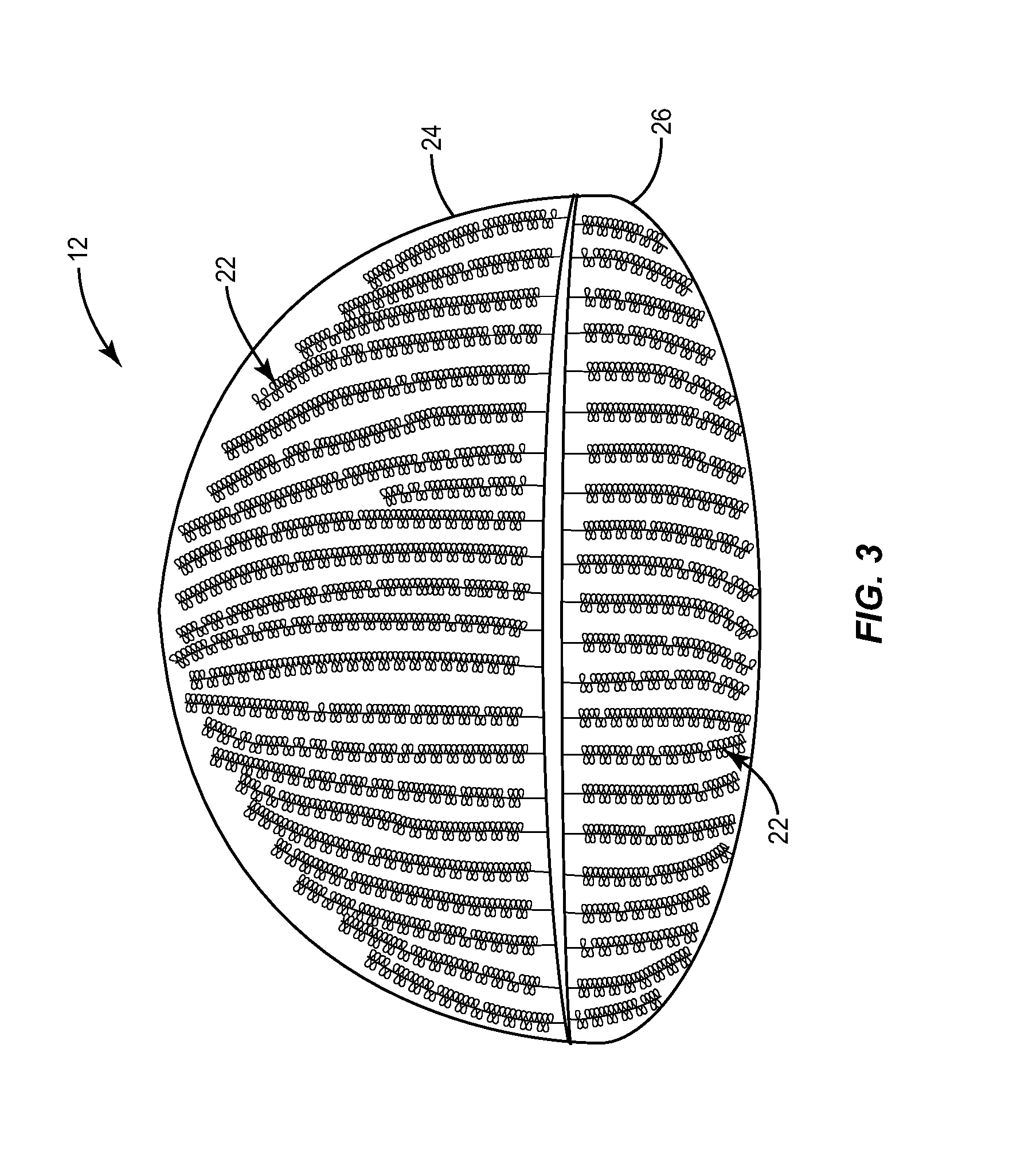Apparatuses and methods for diagnosing and/or treating lipid transport deficiency in ocular tear films, and related components and devices