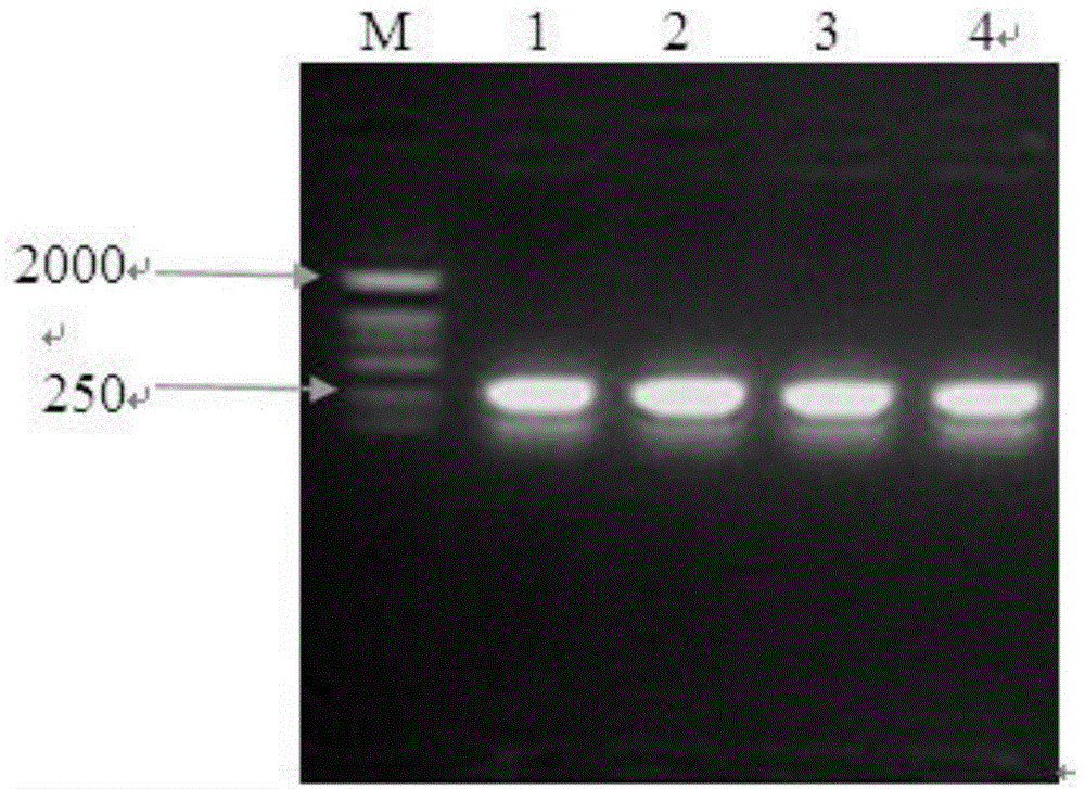 Selecting method of gene participating in transfection of exogenous DNA from sperm