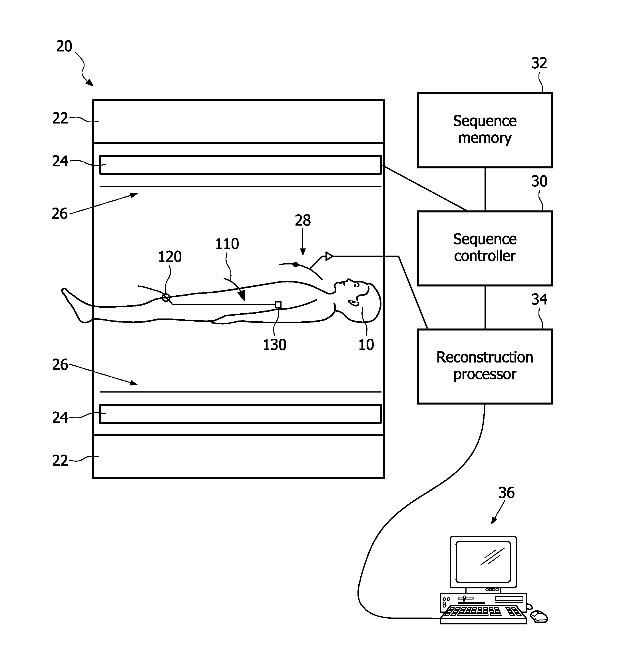 System, method and apparatus for cardiac intervention with mr stroke detection and treatment