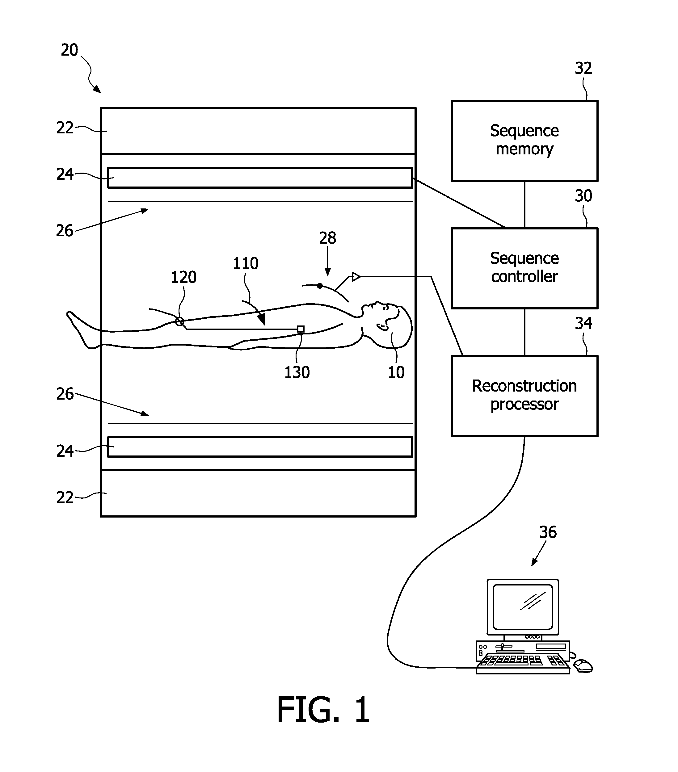 System, method and apparatus for cardiac intervention with mr stroke detection and treatment