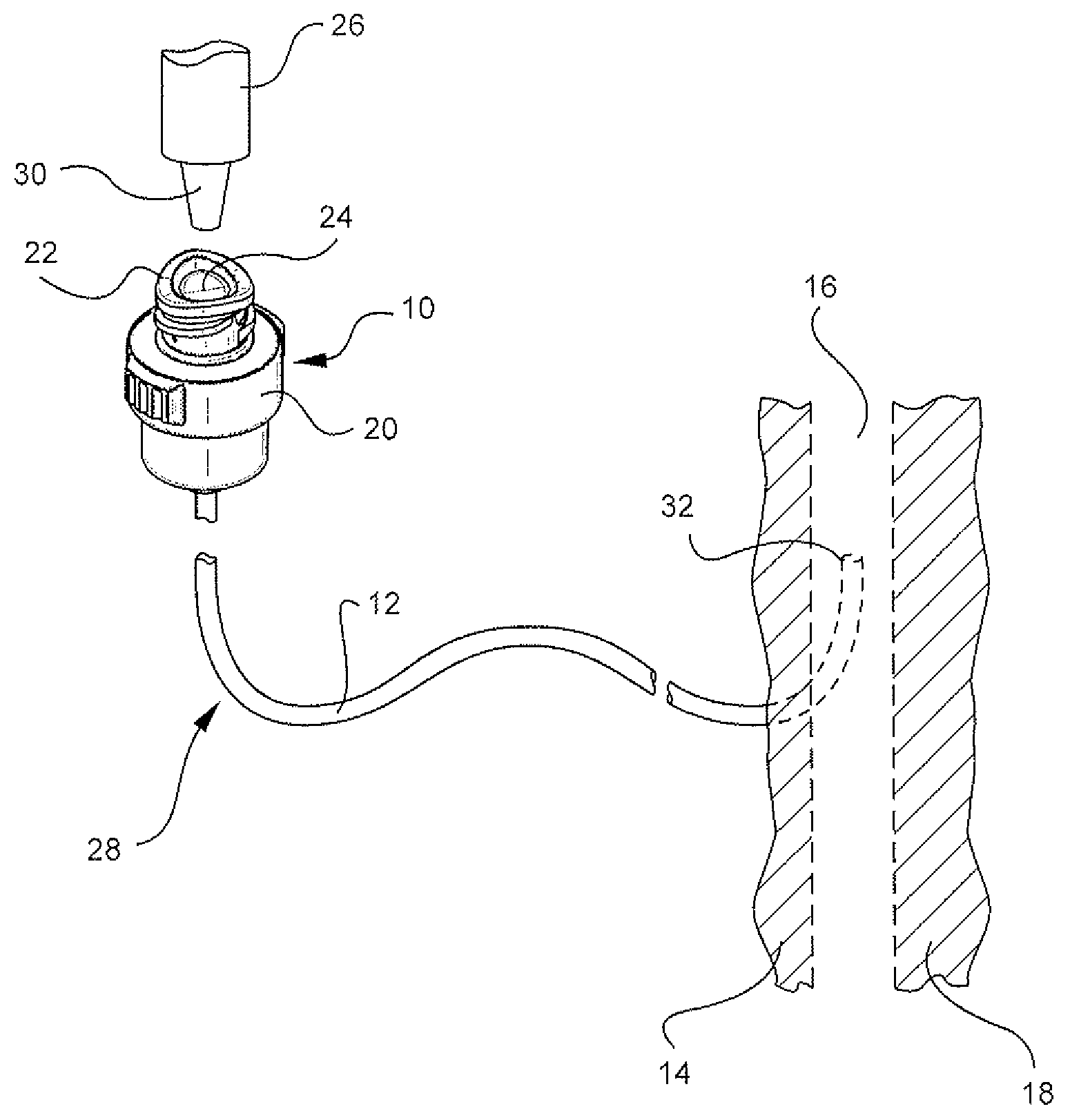 Antimicrobial vascular access device